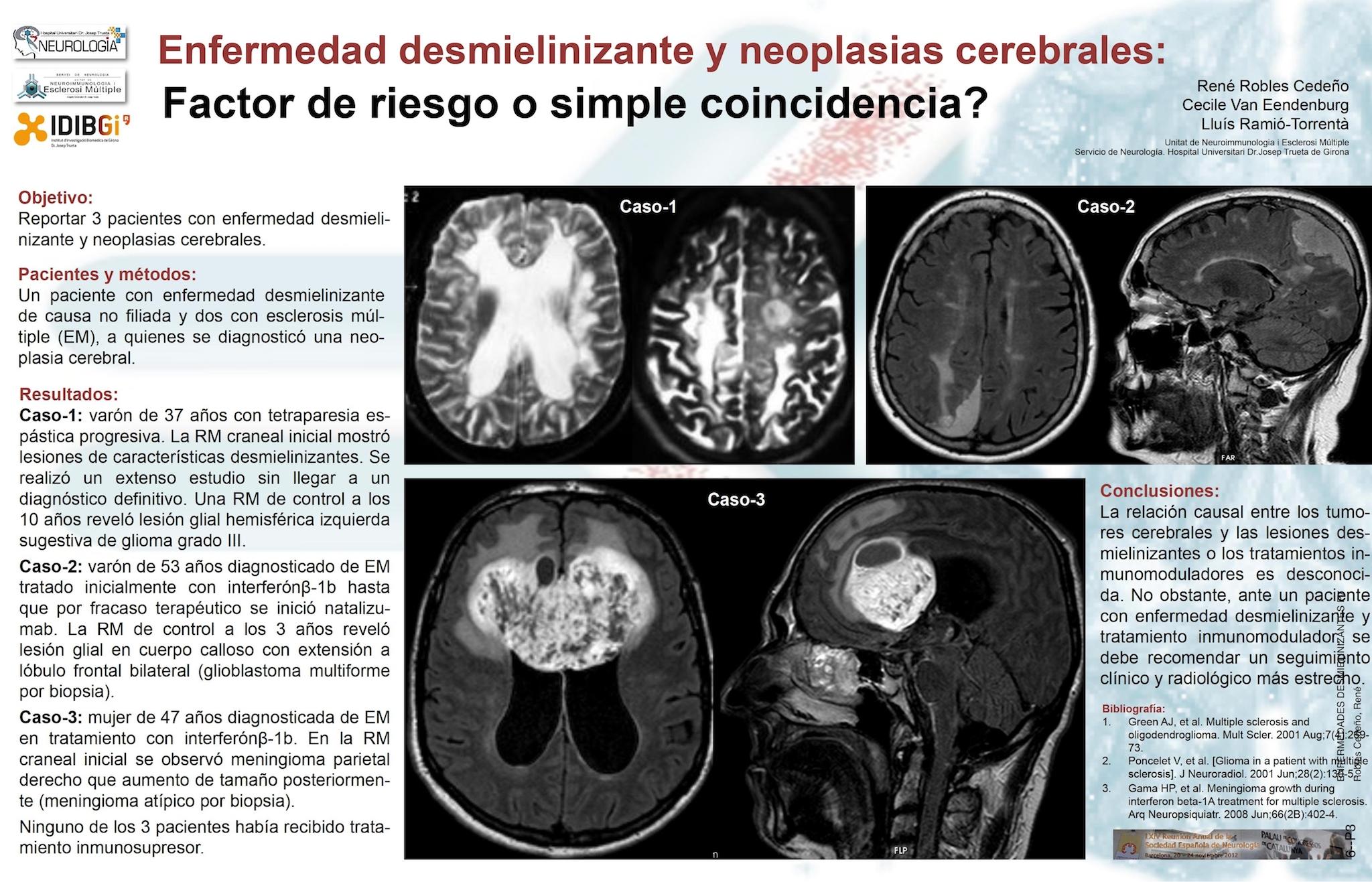 Enfermedad desmielinizante y neoplasias cerebrales: factor de riesgo o simple coincidencia? Reporte de 3 casos y revisión de la literatura