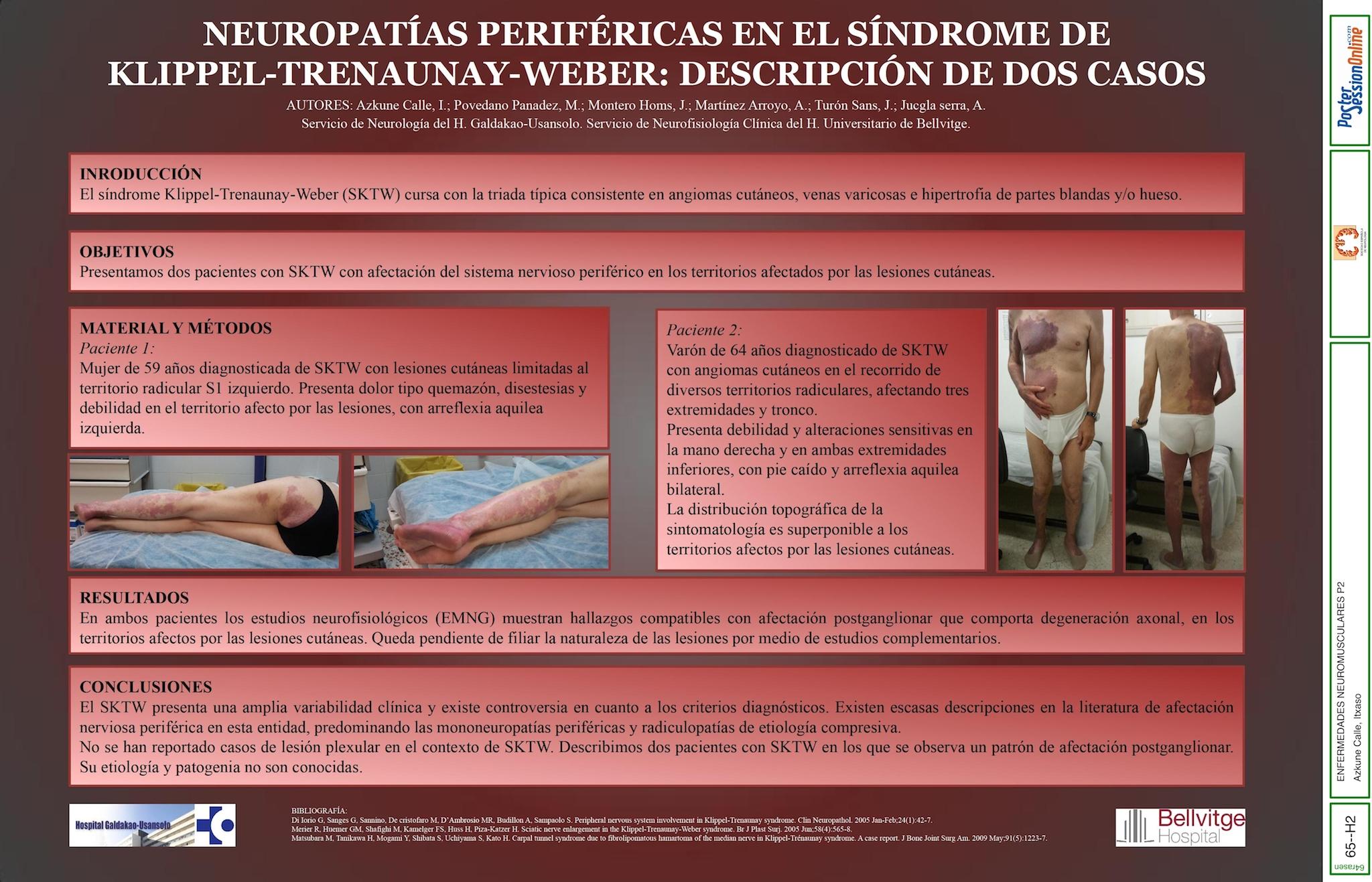 NEUROPATÍAS PERIFÉRICAS EN EL SÍNDROME DE KLIPPEL-TRENAUNAY-WEBER: DESCRIPCIÓN DE DOS CASOS