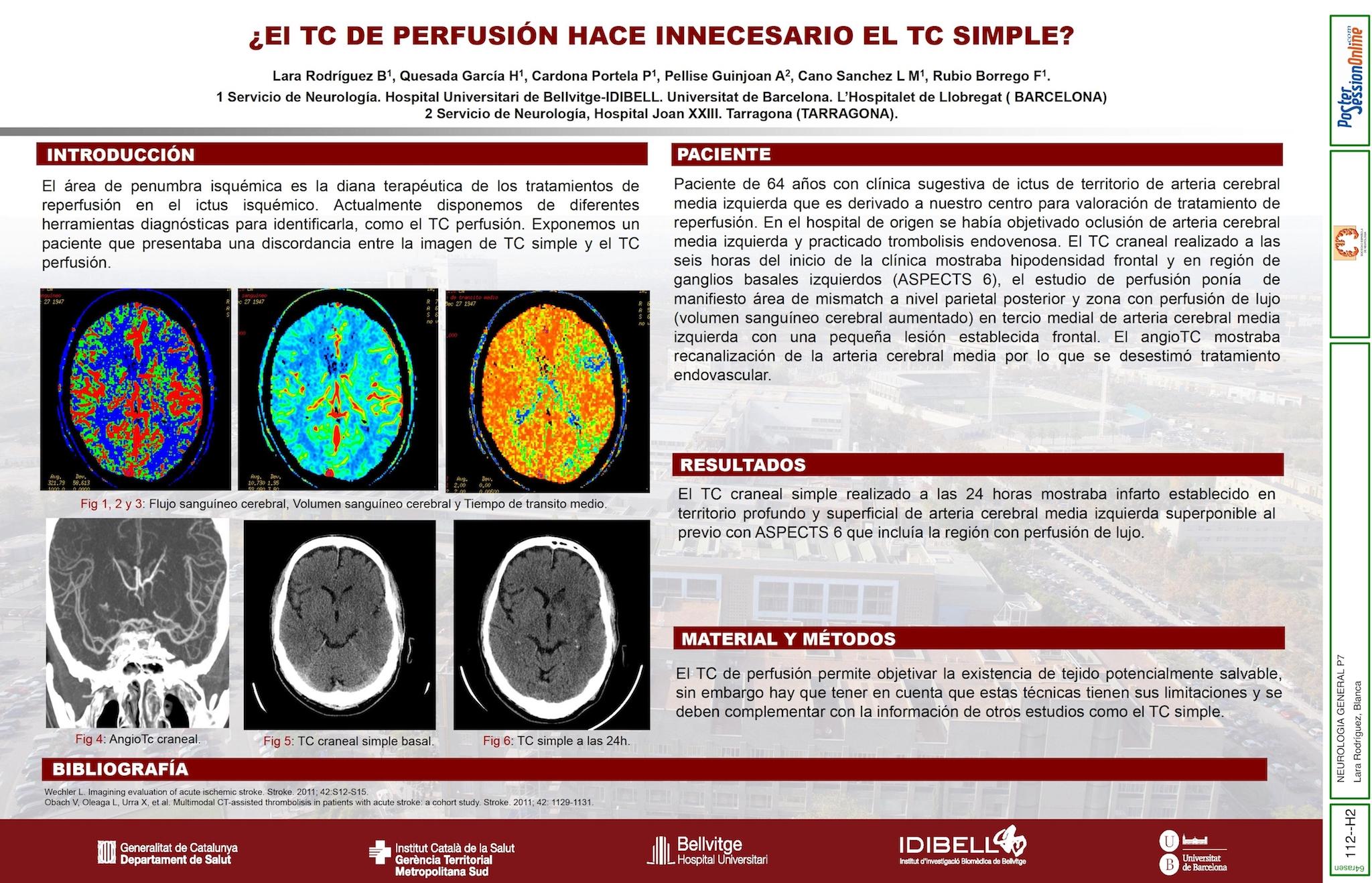 ¿EL TC PERFUSIÓN HACE INNECESARIO EL TC SIMPLE?