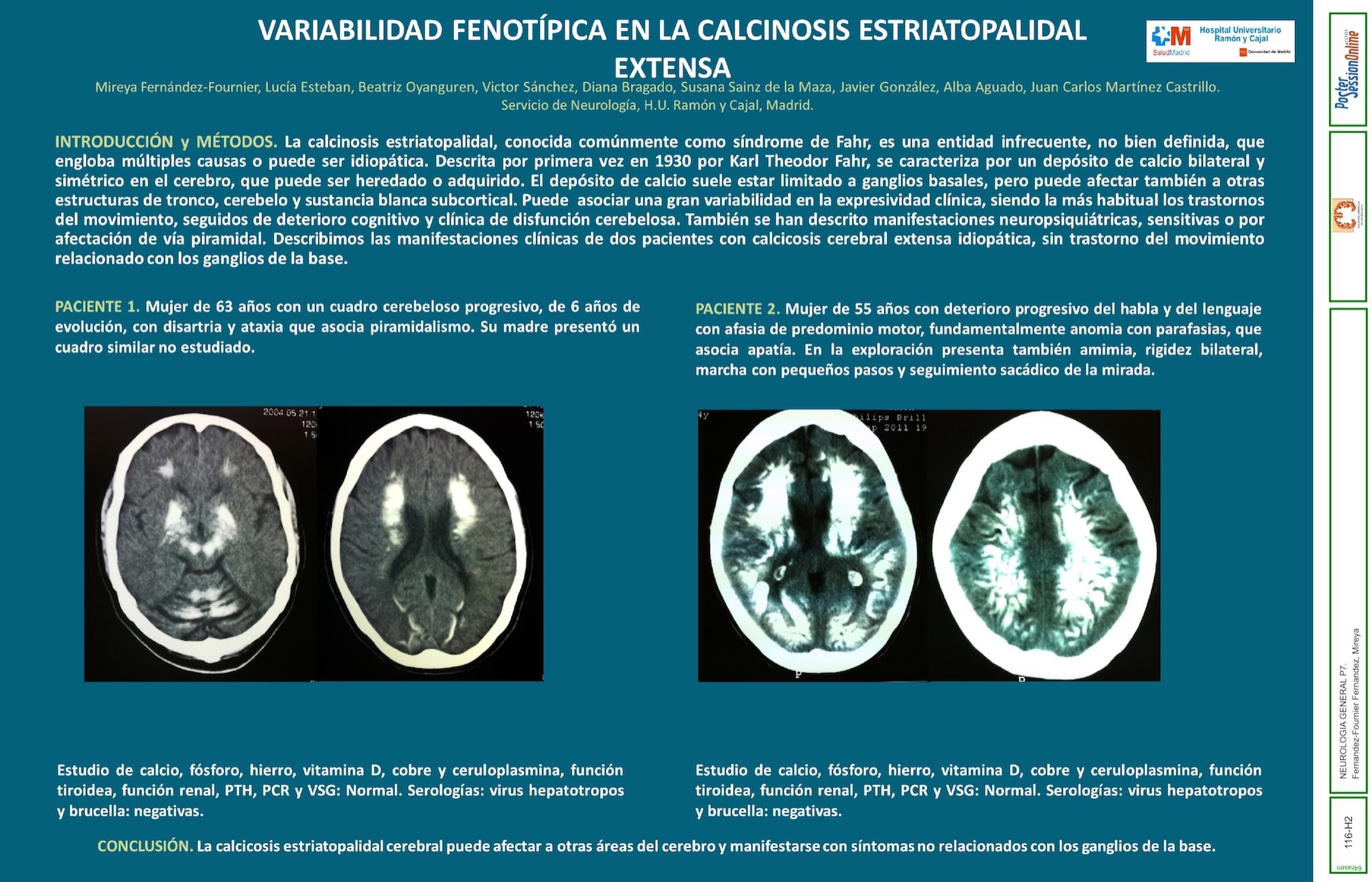 VARIABILIDAD FENOTÍPICA EN LA CALCINOSIS ESTRIATOPALIDAL EXTENSA