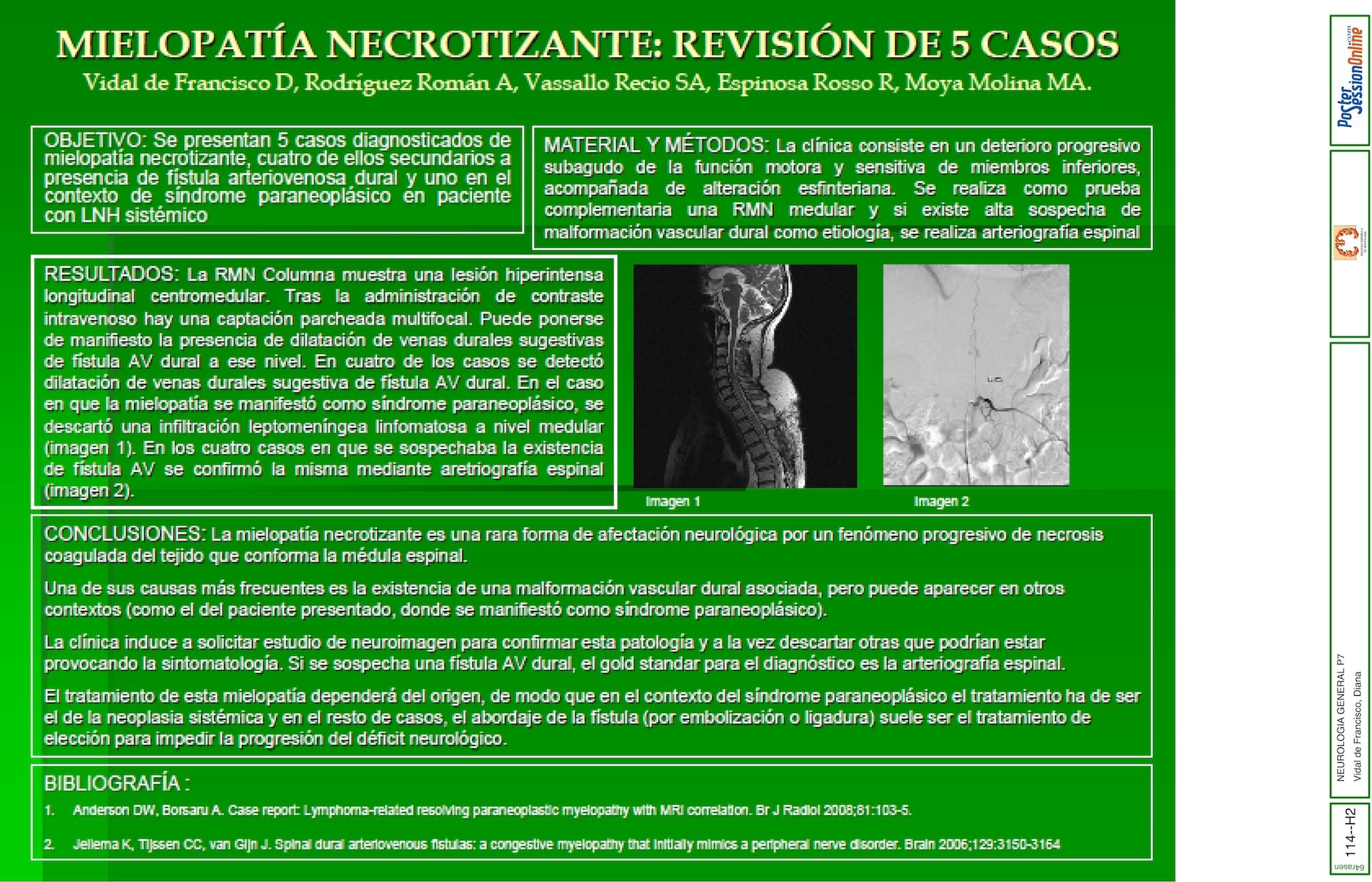 MIELOPATÍA NECROTIZANTE: REVISIÓN DE 5 CASOS