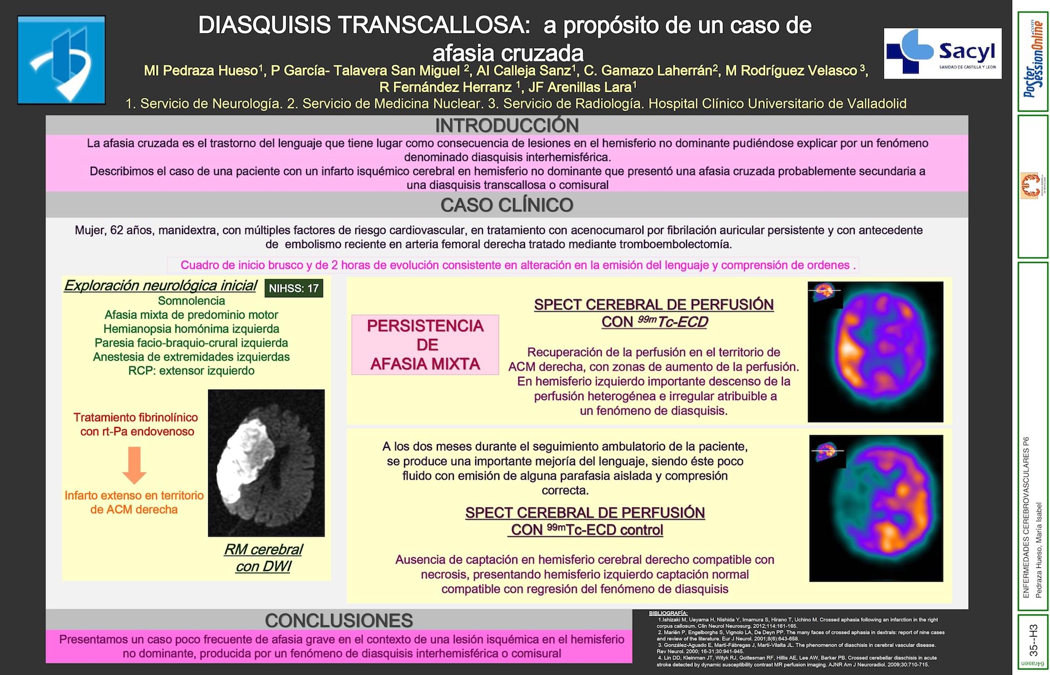 DIASQUISIS INTERHERMISFERICA: a propósito de un caso de afasia cruzada.
