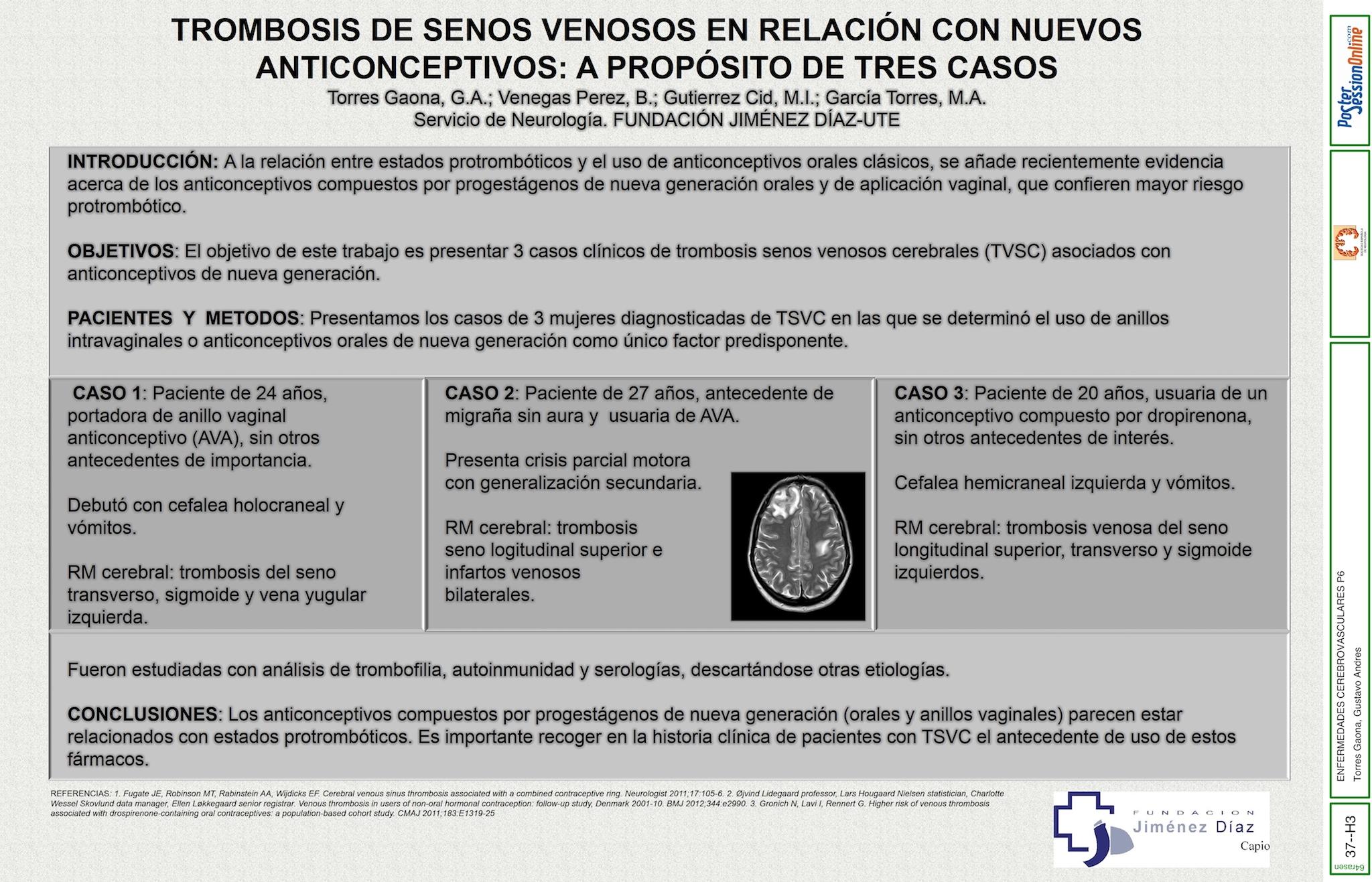 TROMBOSIS SE SENOS VENOSOS EN RELACIÓN CON NUEVOS ANTICONCEPTIVOS: A PROPÓSITO DE TRES CASOS