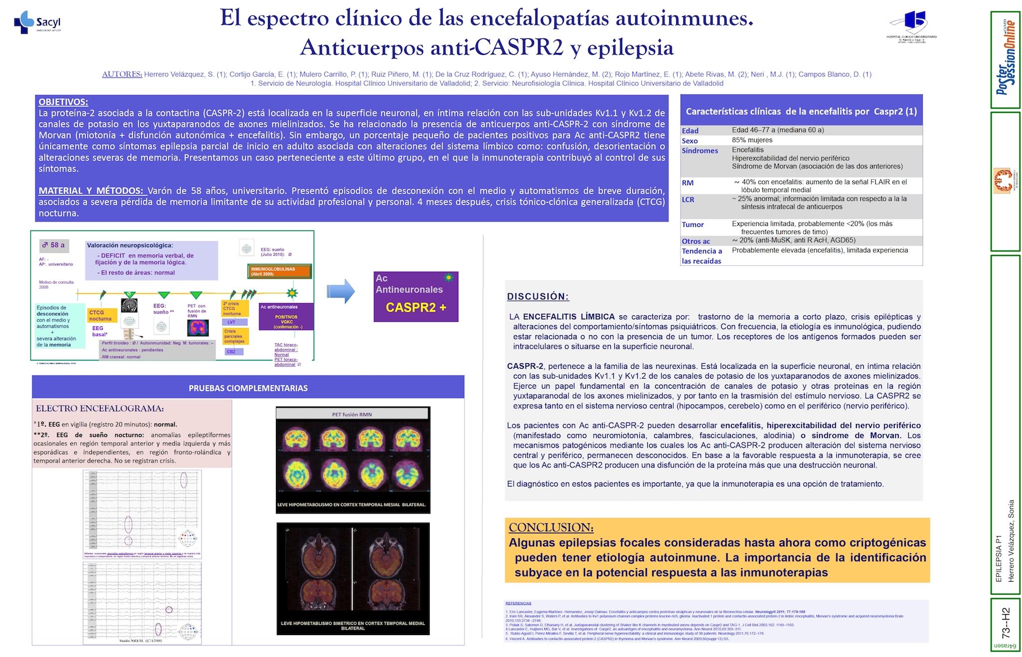 El espectro clínico de las encefalopatías autoinmunes: Anticuerpos anti-CASPR2 y epilepsia