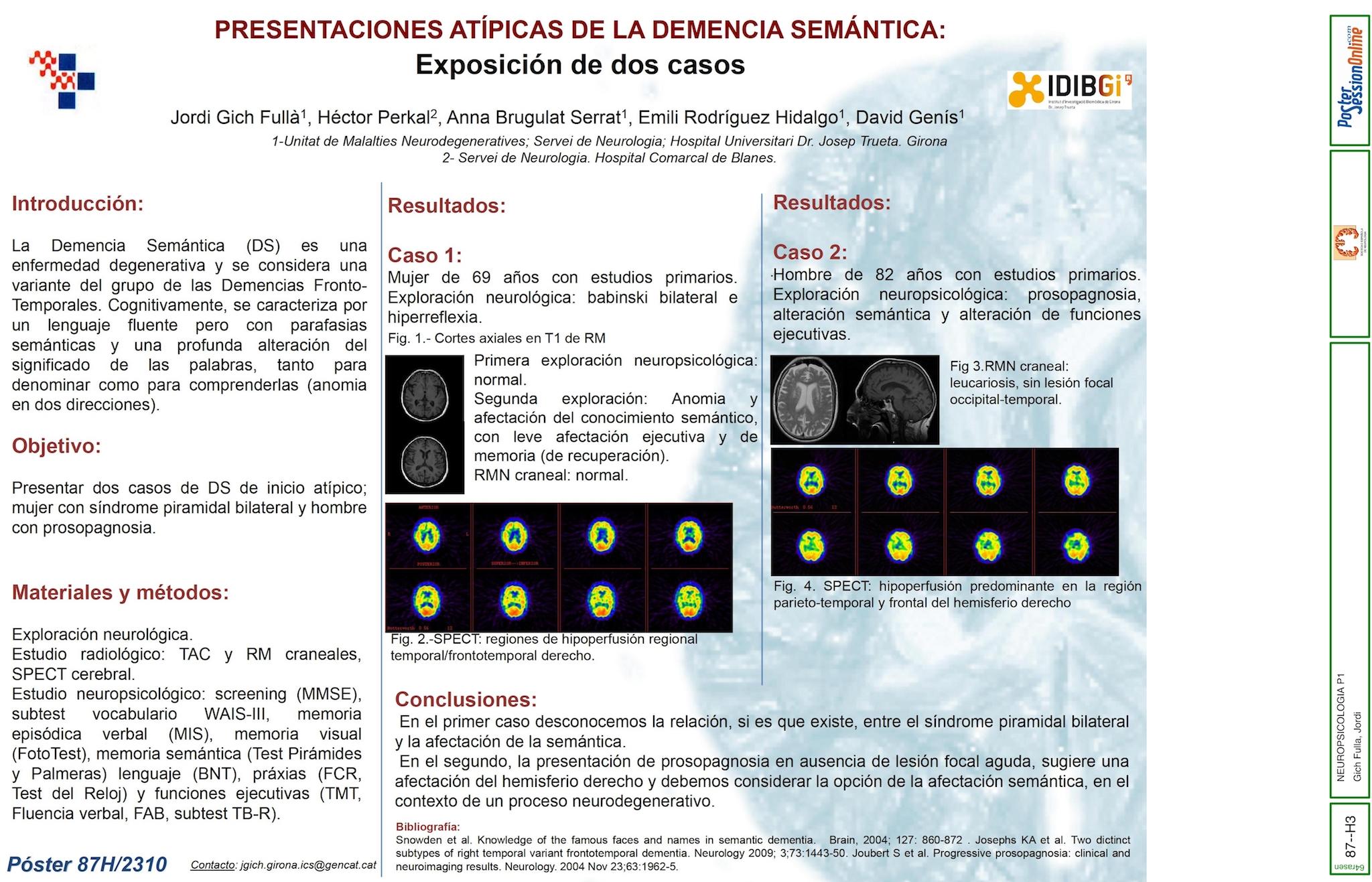 Presentaciones atípicas de la Demencia Semántica: exposición de dos casos