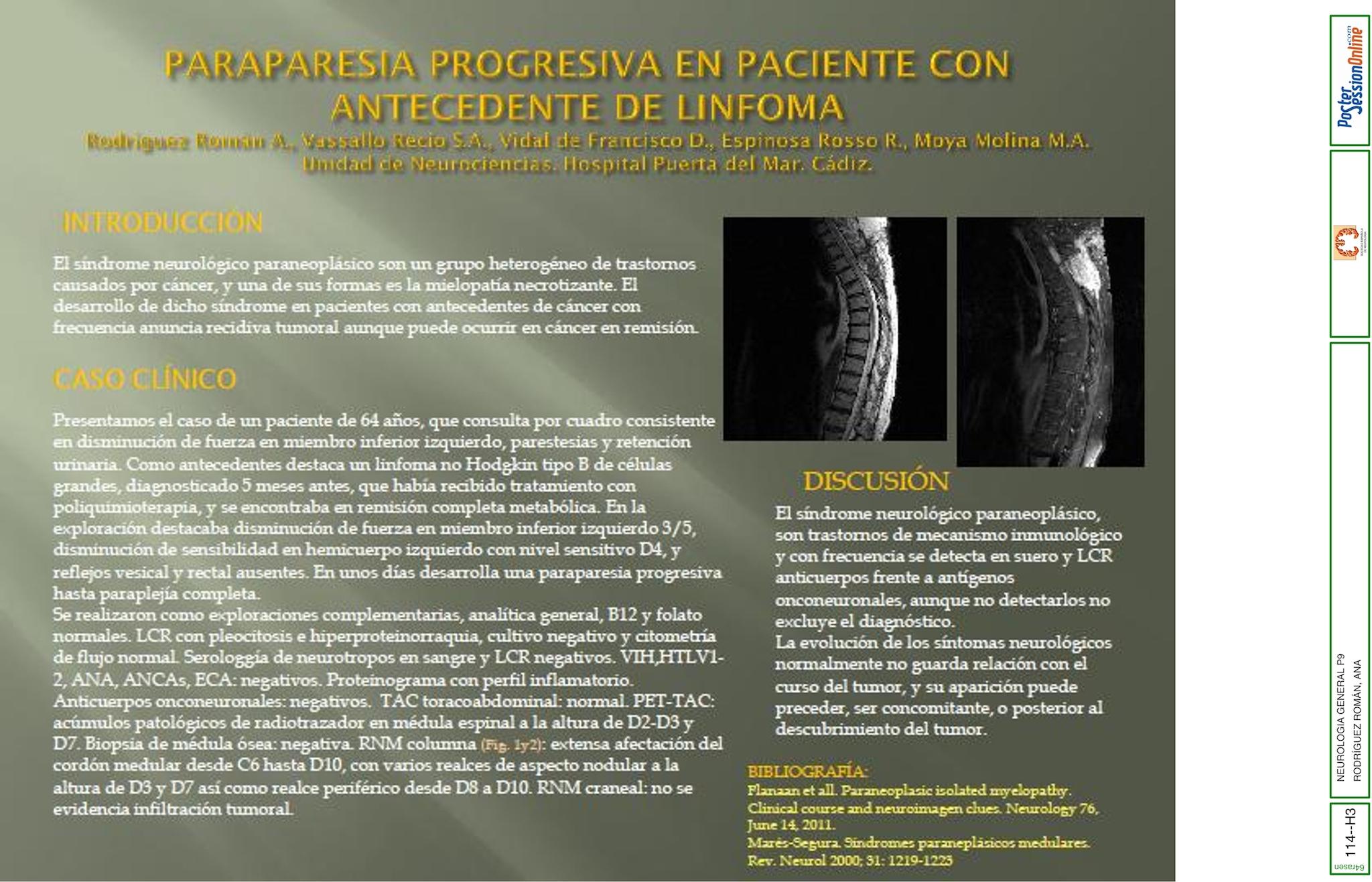 PARAPARESIA PROGRESIVA EN PACIENTE CON ANTECEDENTE DE LINFOMA