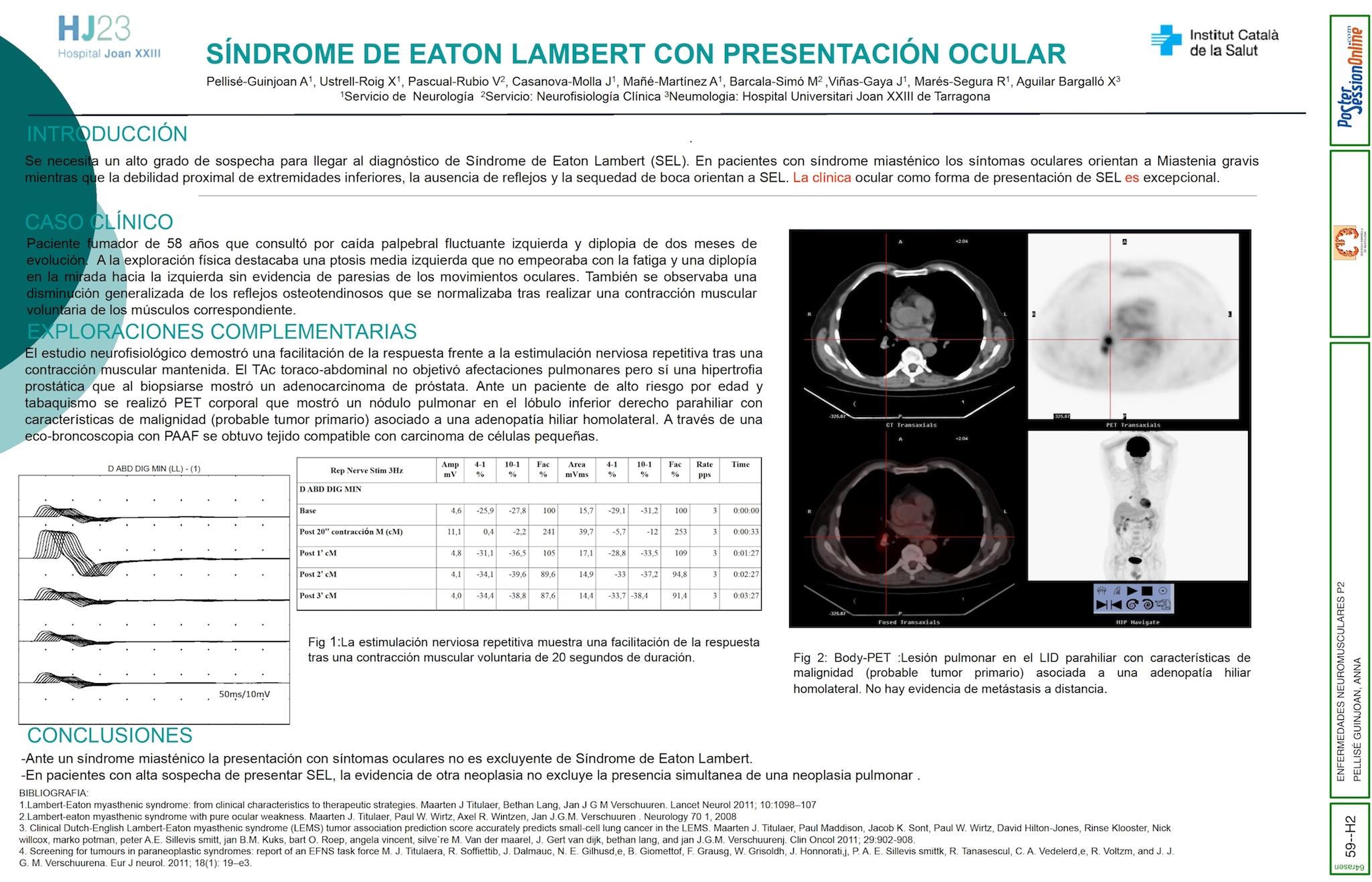 SÍNDROME DE EATON LAMBERT CON PRESENTACIÓN OCULAR