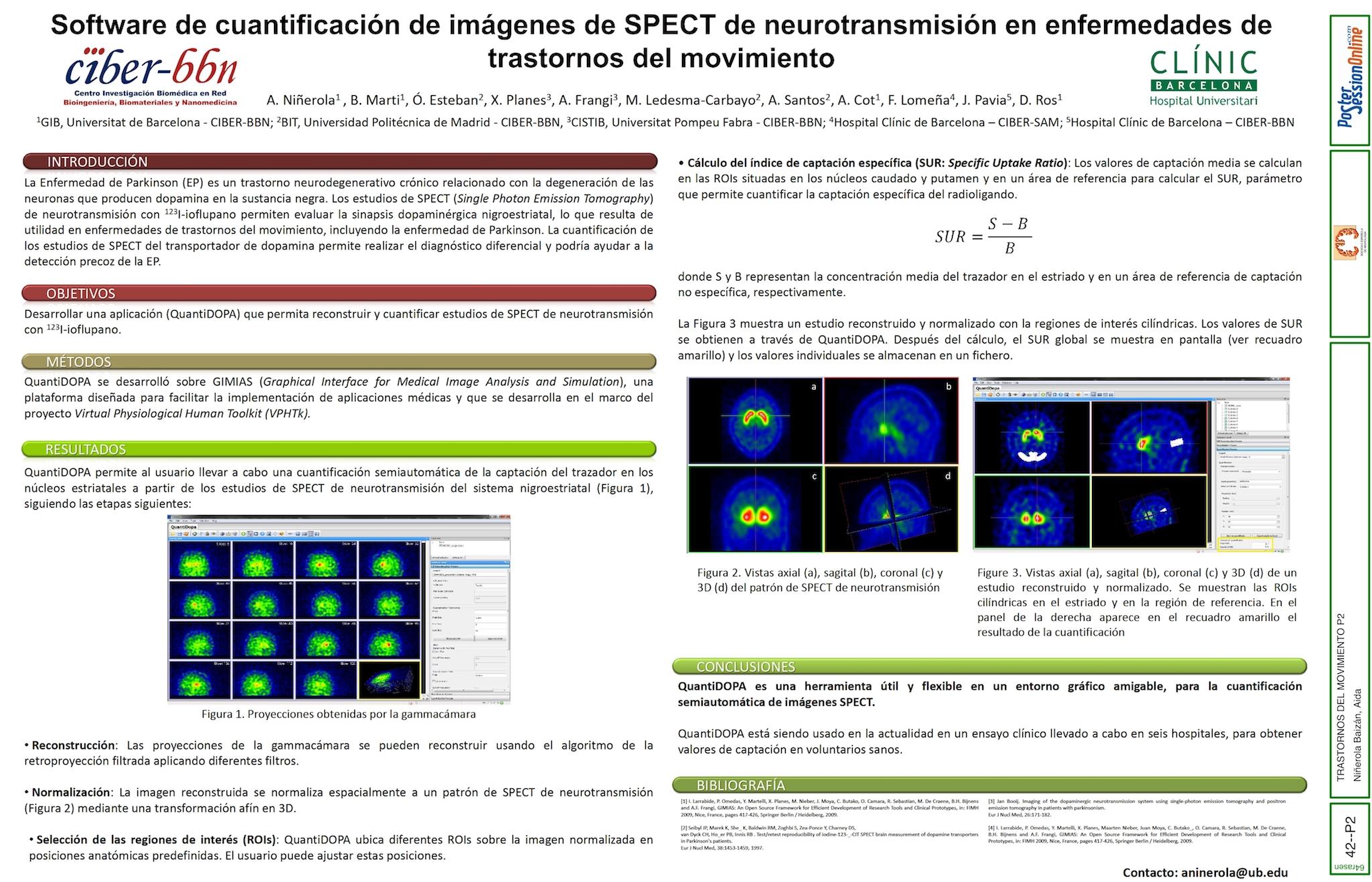 Software de cuantificación de imágenes de SPECT de neurotransmisión en enfermedades de trastornos del movimiento