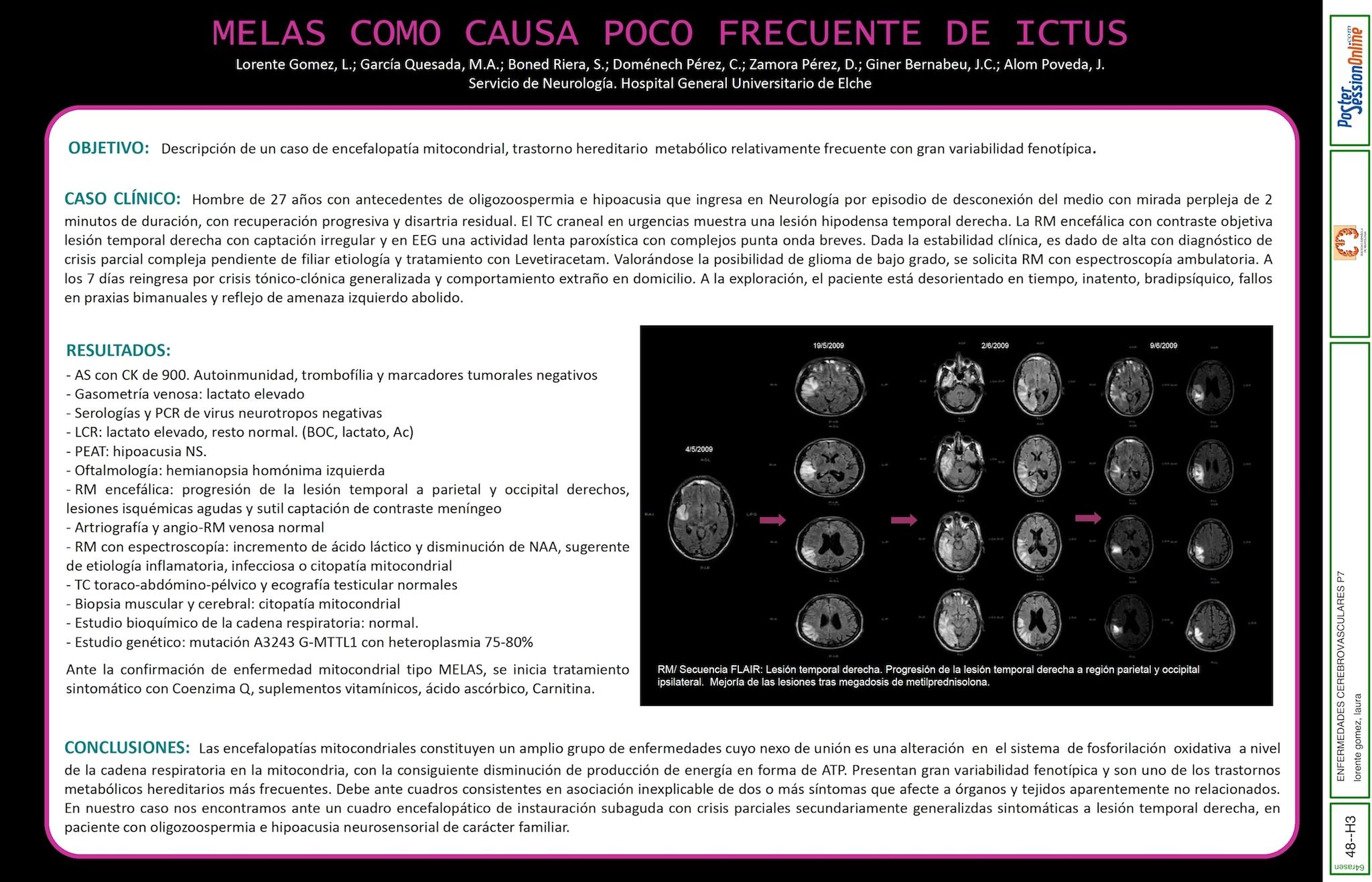 MELAS COMO CAUSA POCO FRECUENTE DE ICTUS