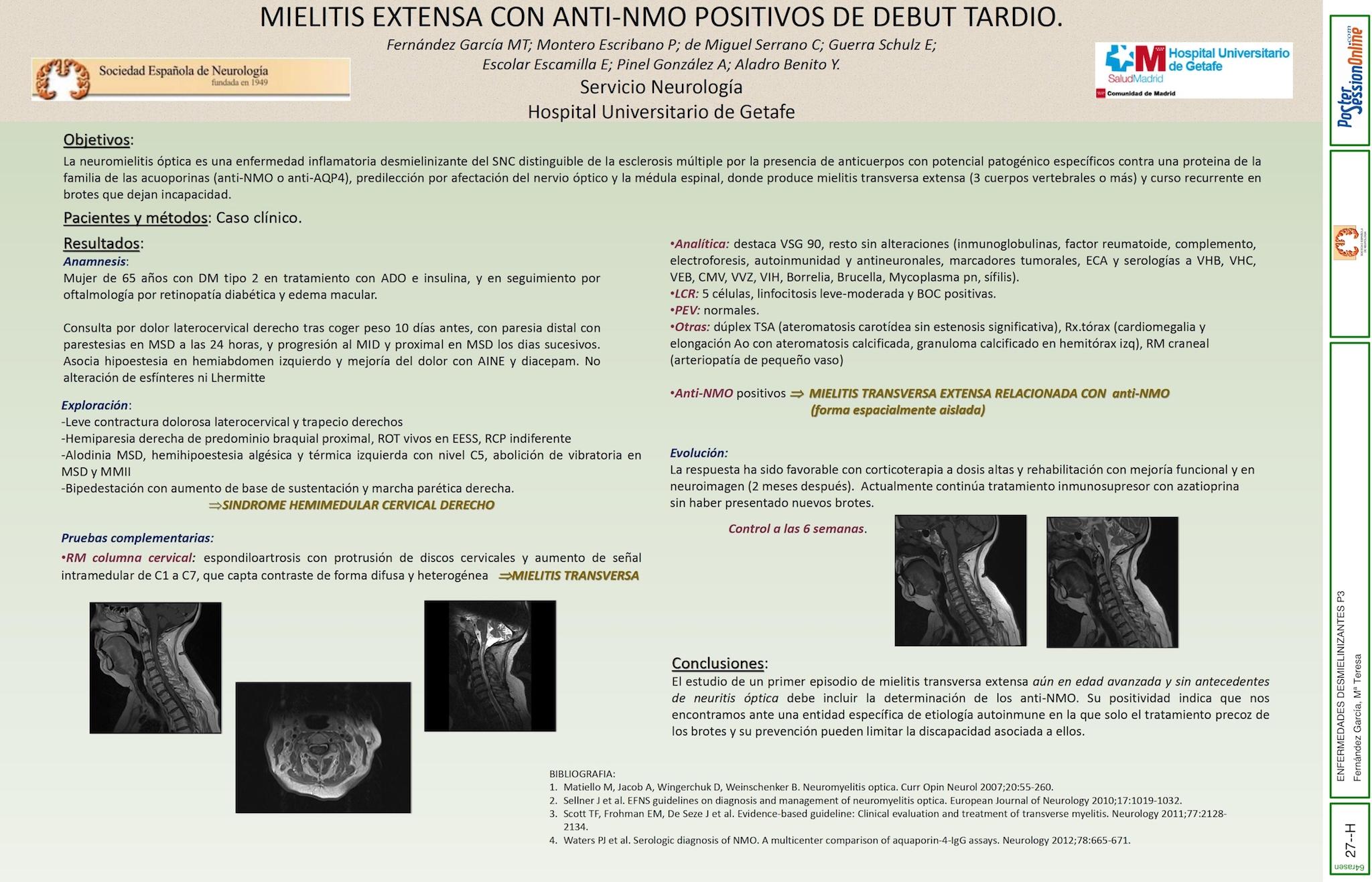 MIELITIS EXTENSA CON ANTI-NMO POSITIVOS DE DEBUT TARDIO.