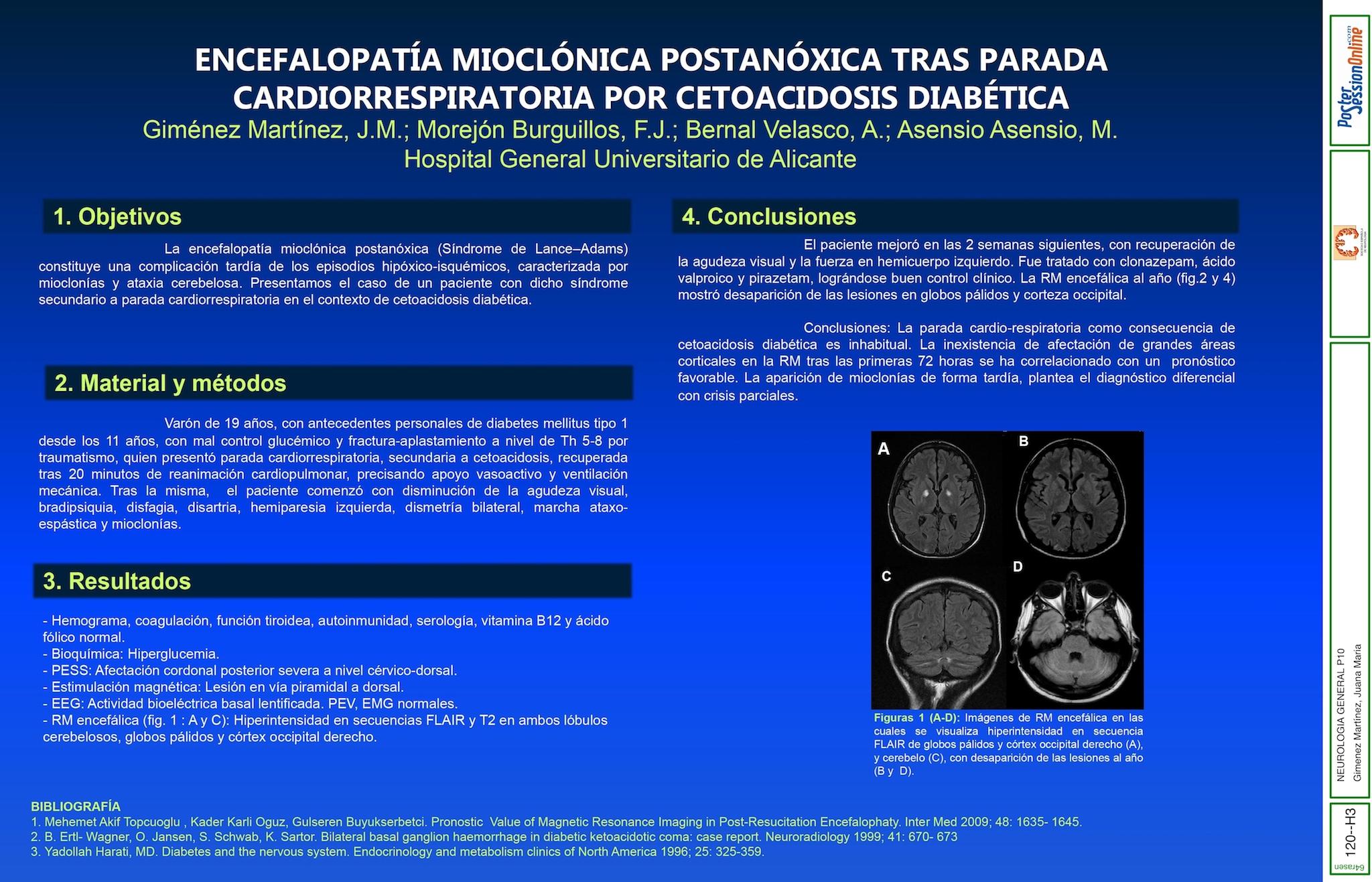 ENCEFALOPATÍA MIOCLÓNICA POSTANÓXICA TRAS PARADA CARDIORRESPIRATORIA POR CETOACIDOSIS DIABÉTICA