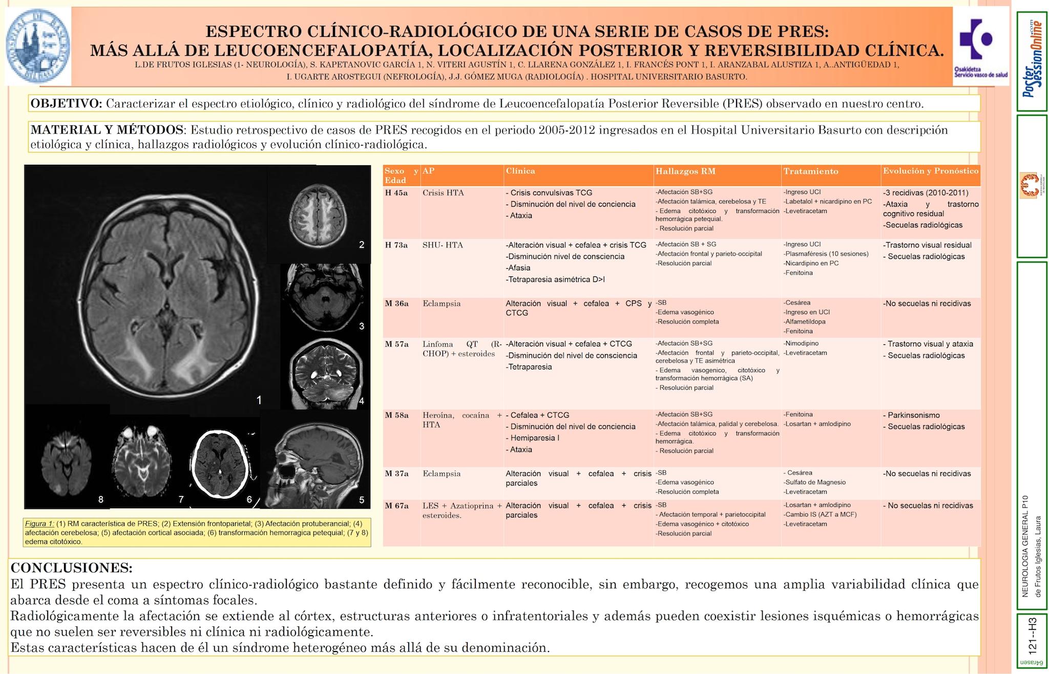 Espectro clínico-radiológico de una serie de casos de PRES: Más allá de leucoencefalopatía, localización posterior y reversibilidad clínica.