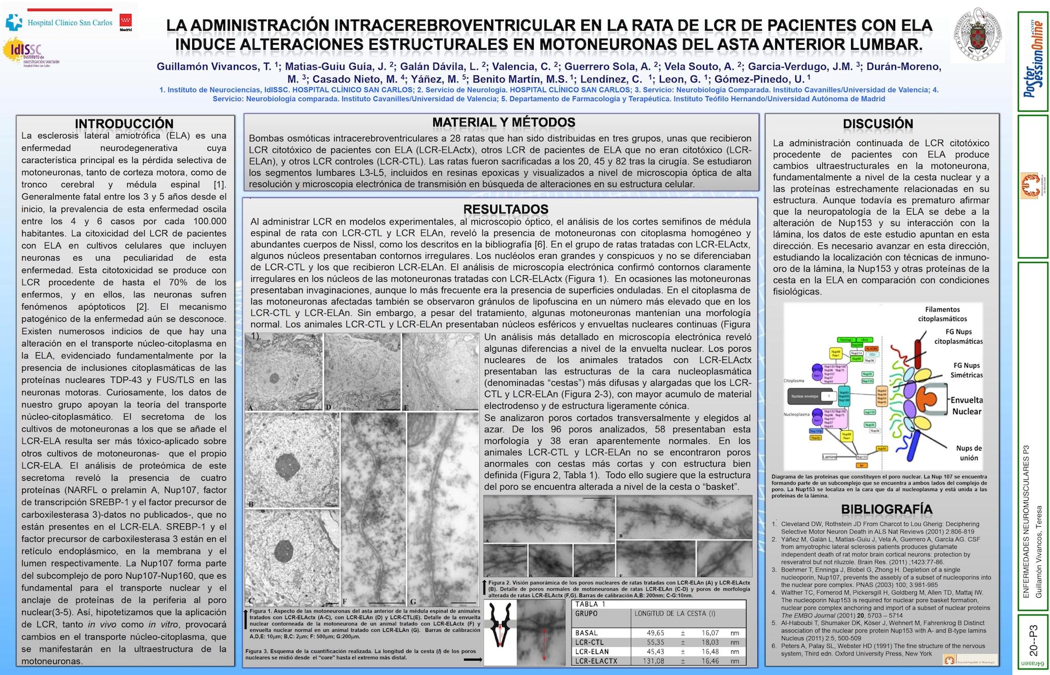 LA ADMINISTRACIÓN INTRACEREBROVENTRICULAR EN LA RATA DE LCR DE PACIENTES CON ELA INDUCE ALTERACIONES ESTRUCTURALES EN MOTONEURONAS DEL ASTA ANTERIOR LUMBAR.