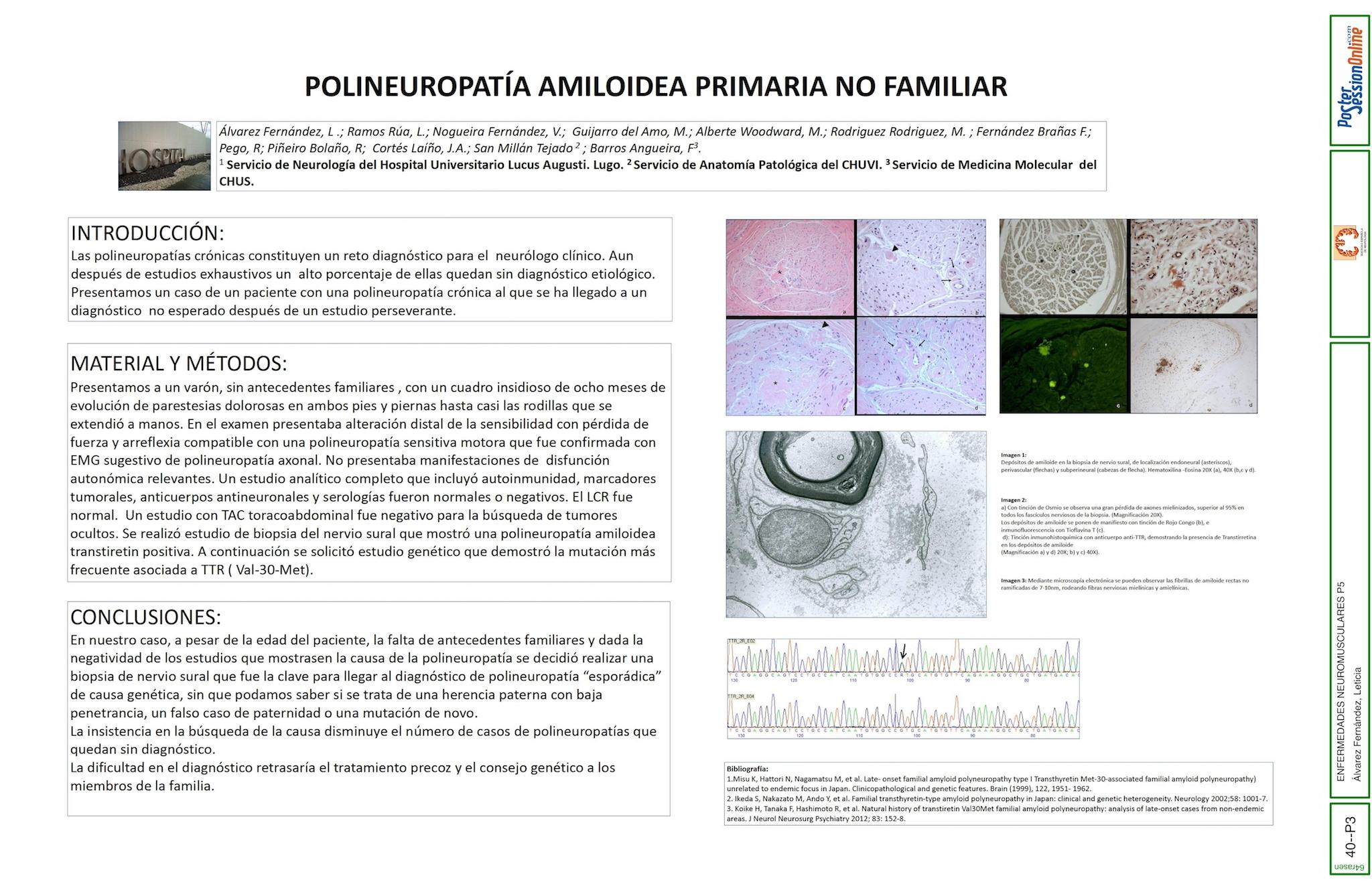 Polineuropatía amiloidea primaria no familiar