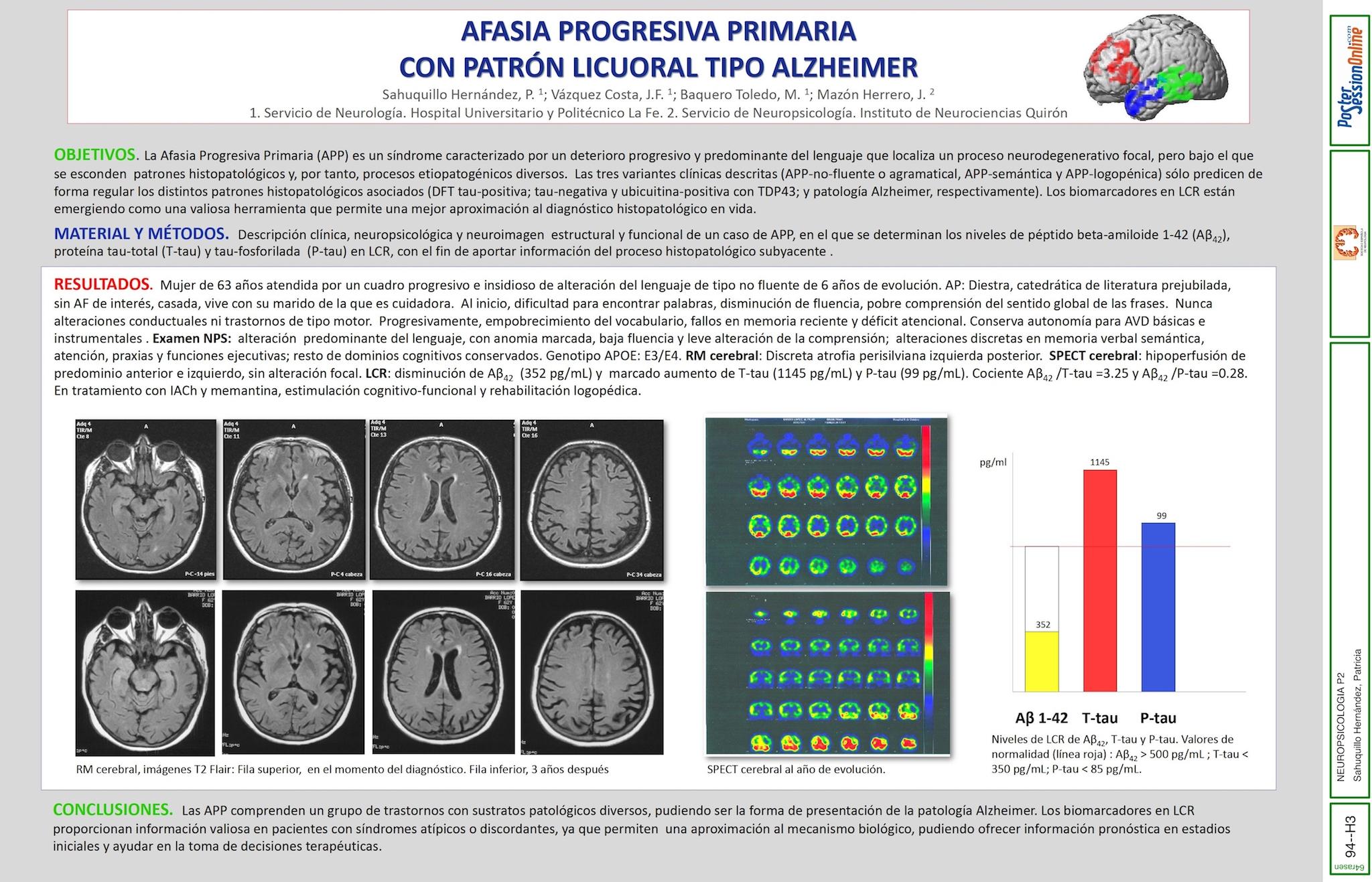 AFASIA PROGRESIVA PRIMARIA CON PATRÓN LICUORAL TIPO ALZHEIMER