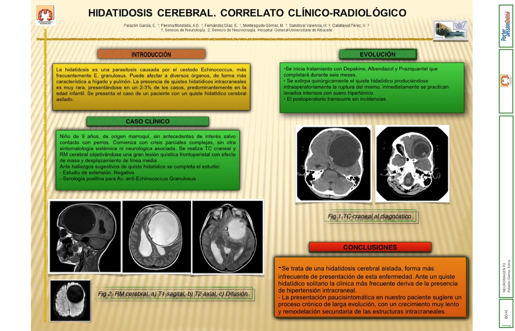 HIDATIDOSIS CEREBRAL. CORRELATO CLINICO-RADIOLÓGICO