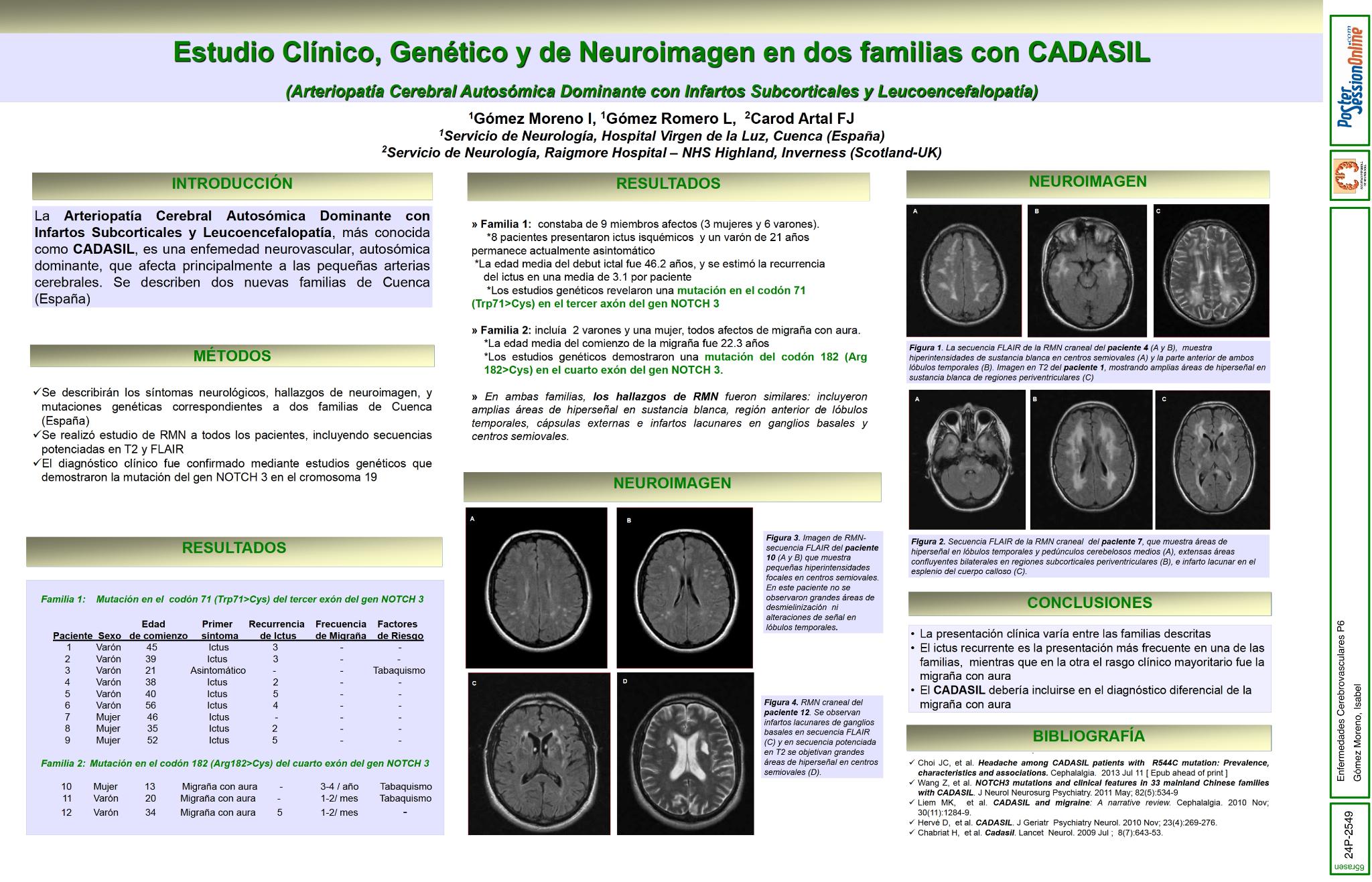 Estudio Clínico,  Genético y de Neuroimagen en dos familias con CADASIL (Arteriopatía Cerebral Autosómica Dominante con Infartos Subcorticales y Leucoencefalopatía)
