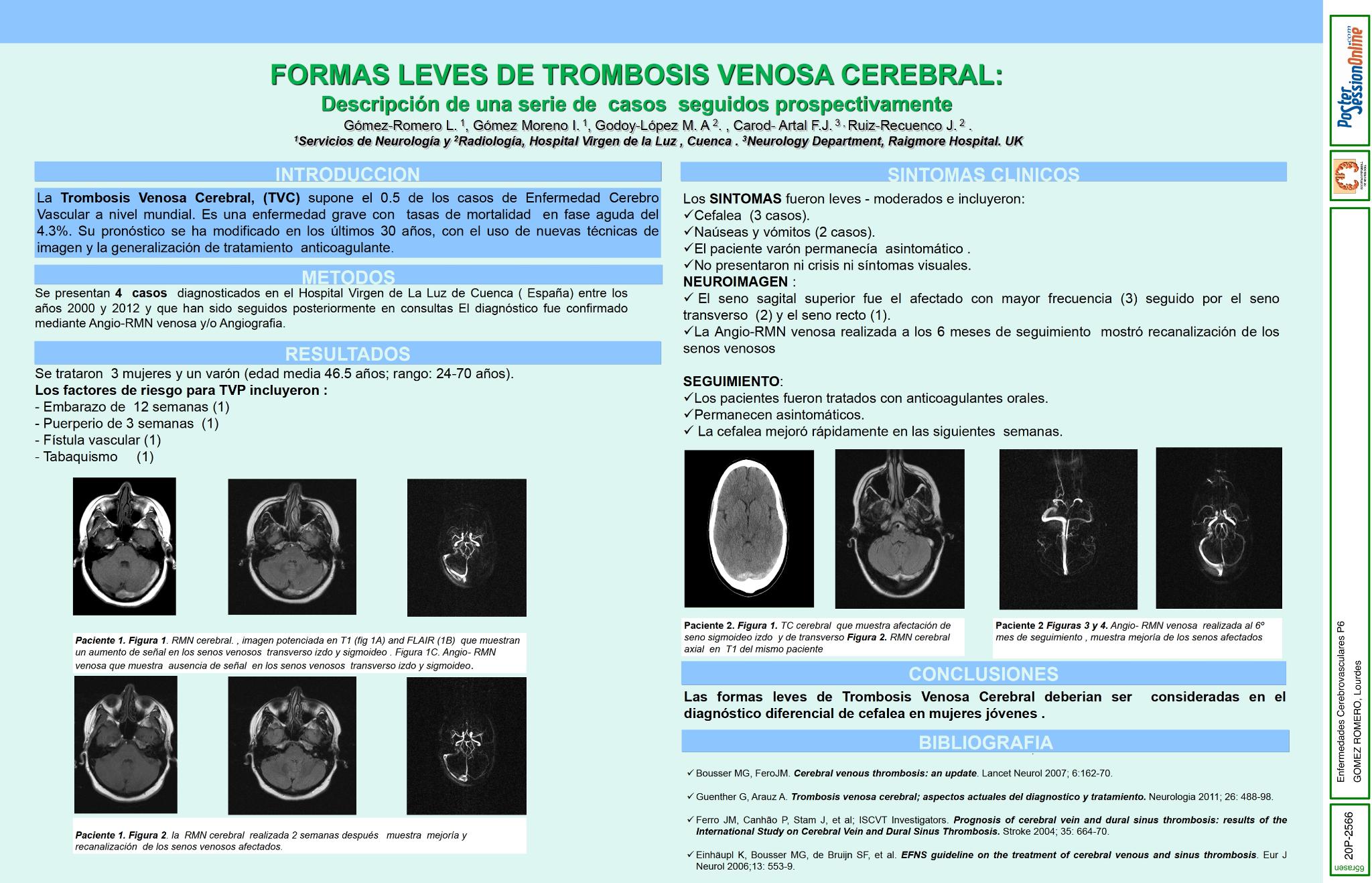 Formas leves de Trombosis Venosa Cerebral: descripcion de una serie de casos