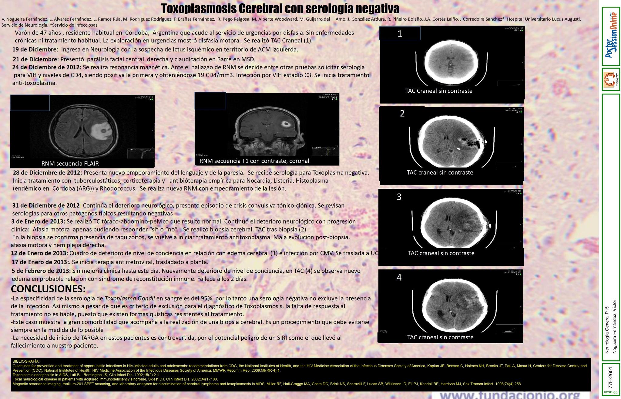 Toxoplasmosis cerebral con serología negativa
