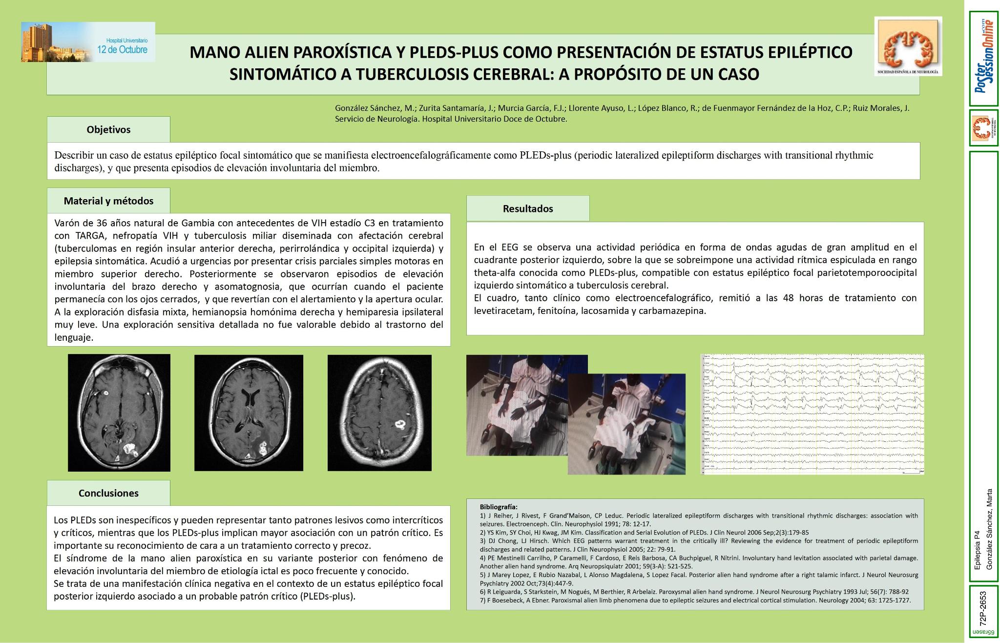 Mano alien paroxística y PLEDs-plus como presentación de estatus epiléptico sintomático a tuberculosis cerebral: a propósito de un caso