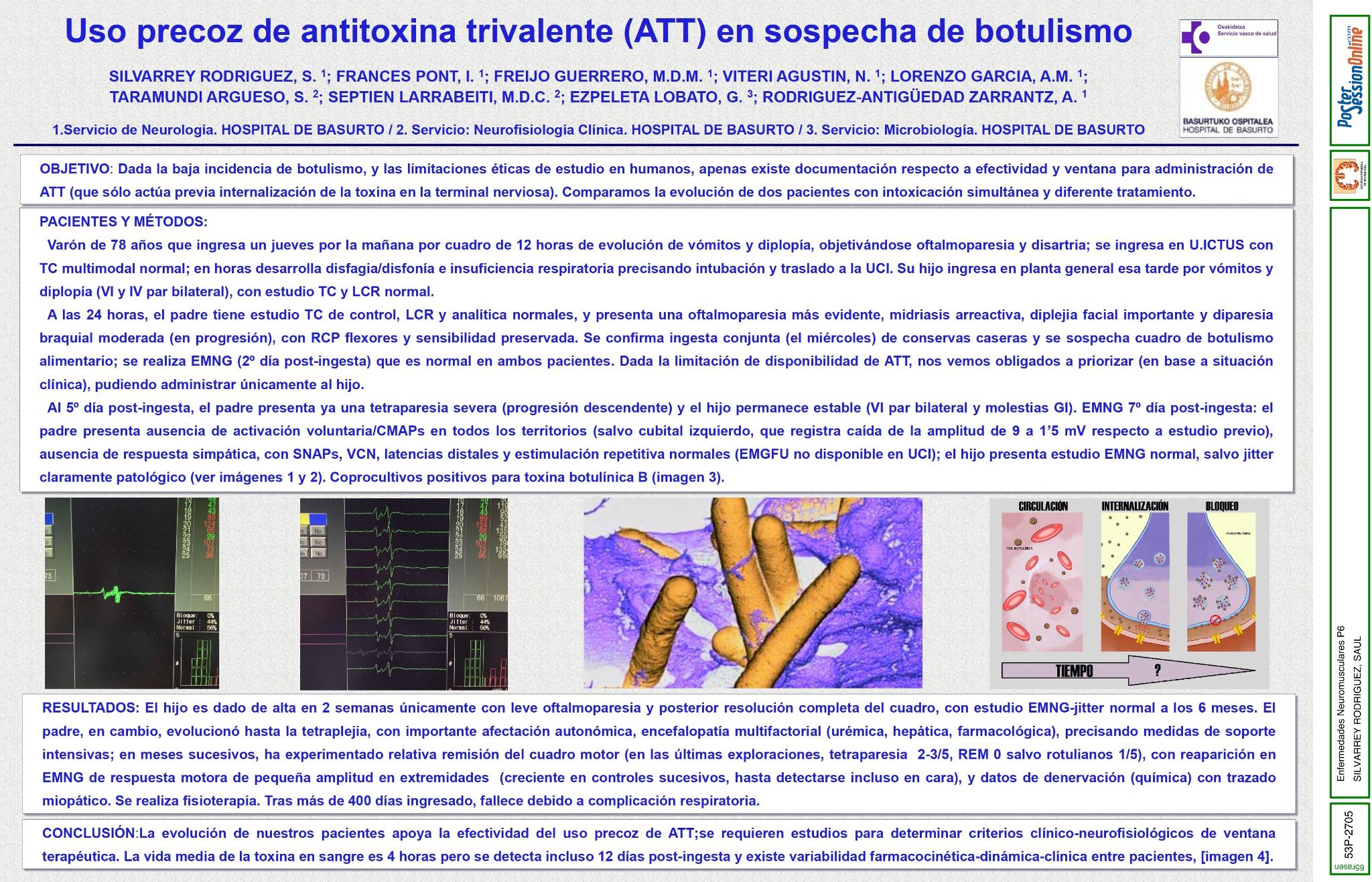 Uso precoz de antitoxina trivalente (ATT) en sospecha de botulismo