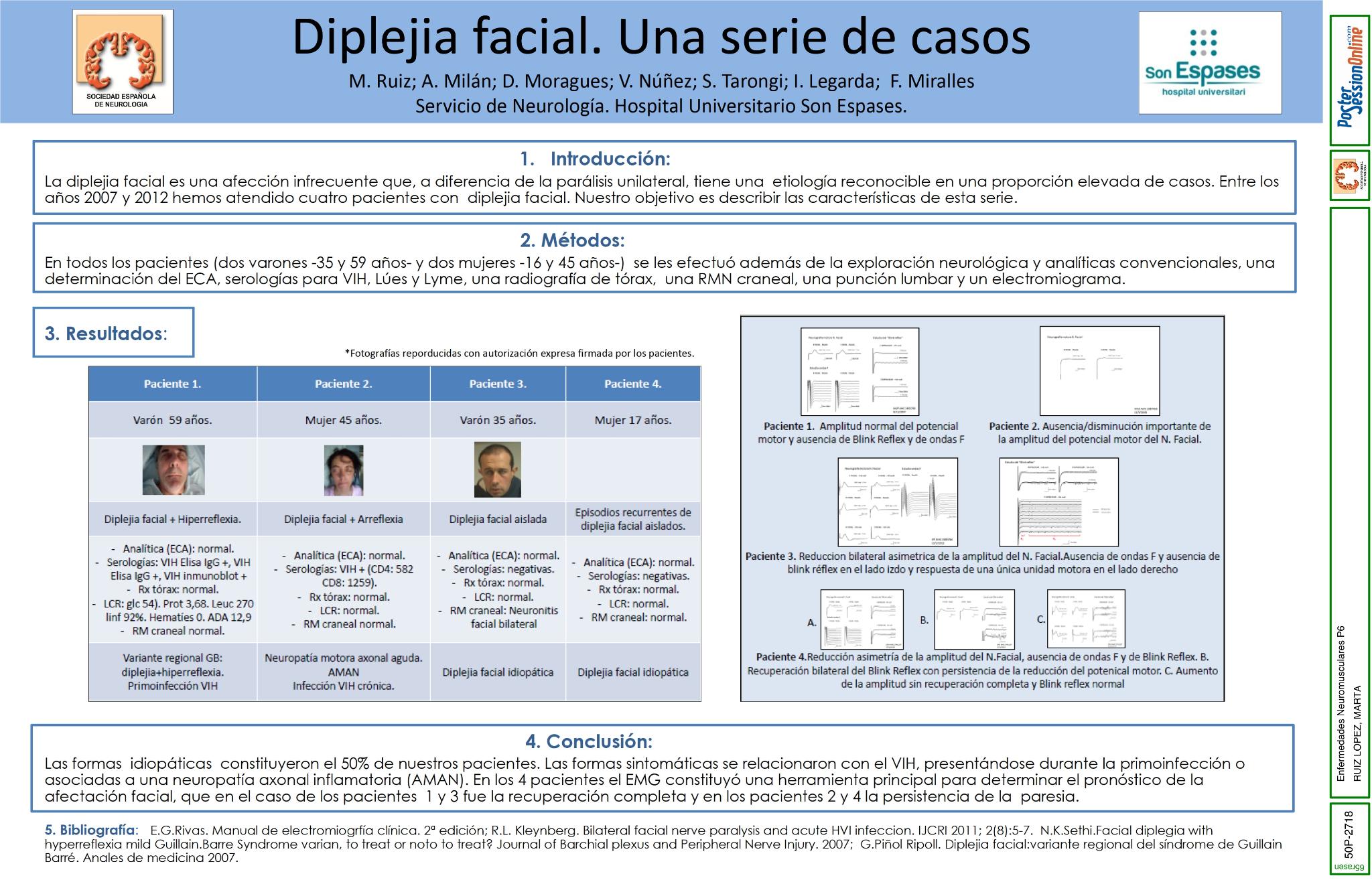 Diplejia facial. Presentación de una serie de casos