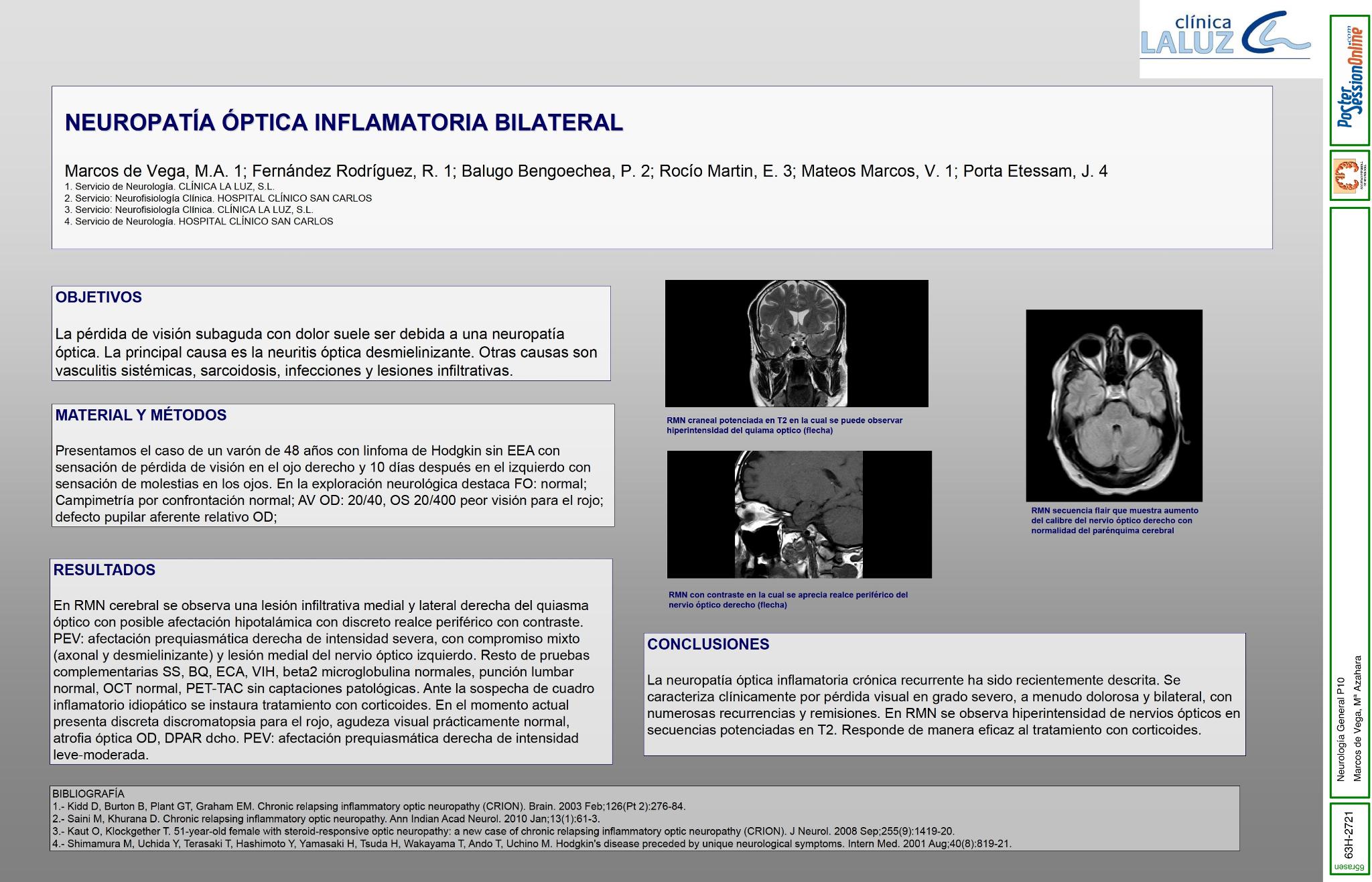 Neuropatía óptica inflamatoria bilateral