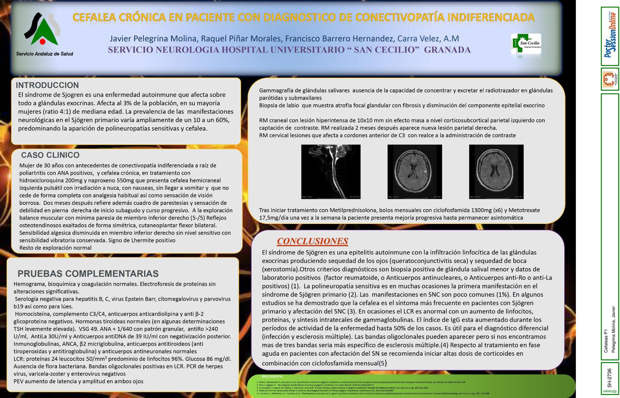 Cefalea  en paciente con diagnostico de conectivopatía indiferenciada.