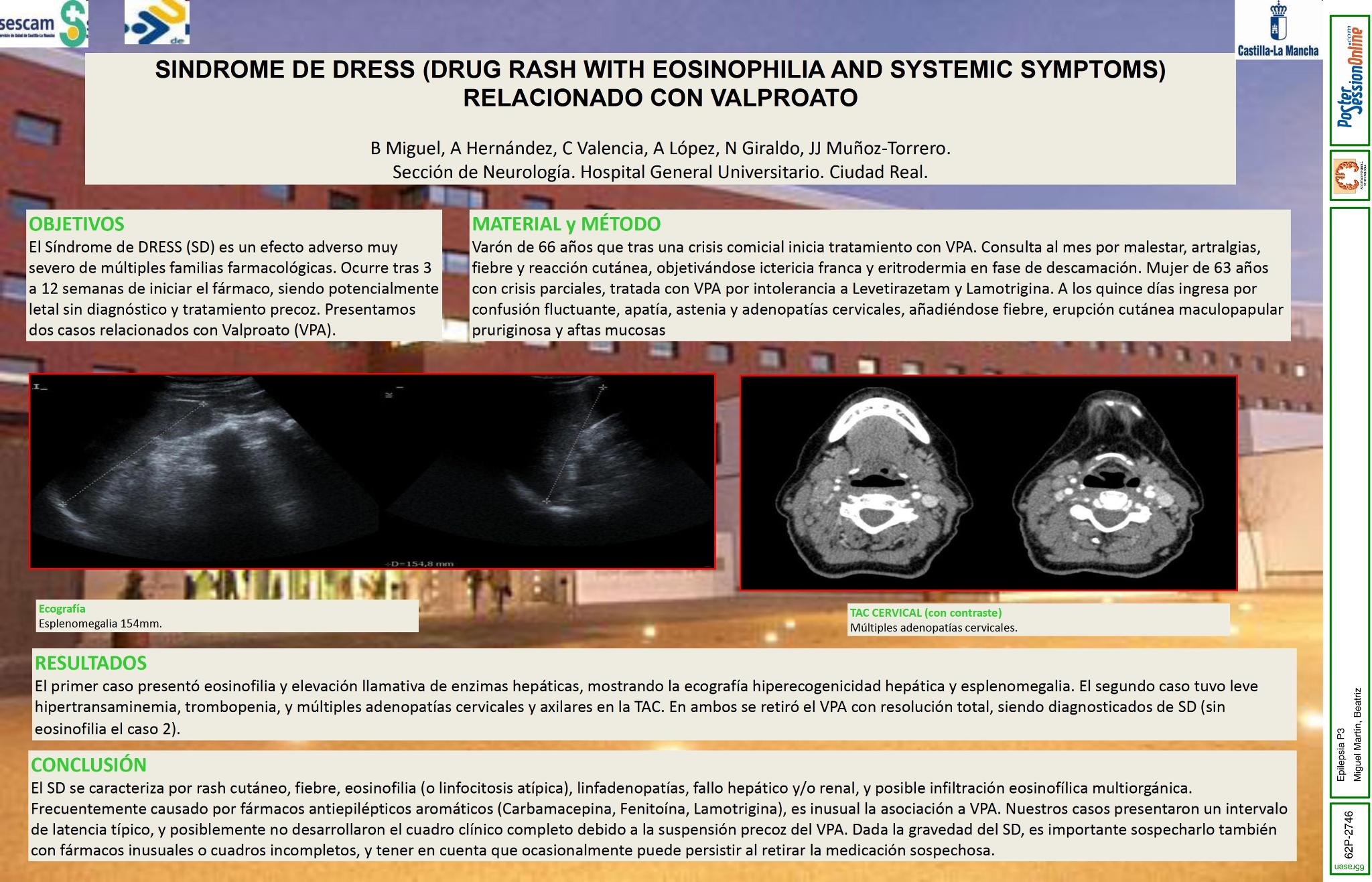 Síndrome de Dress (Drug Rash with Eosinophilia and Systemic Symptoms) relacionado con Valproato