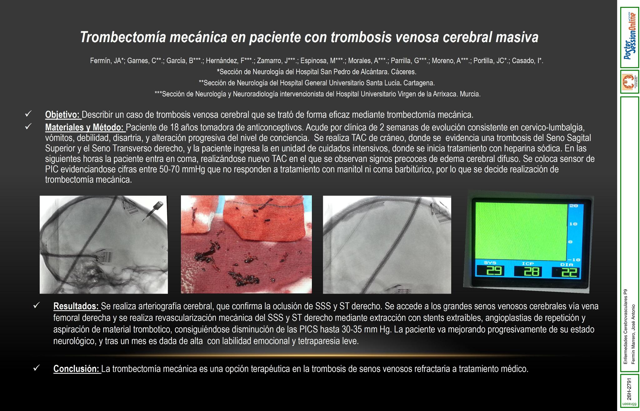 Trombectomía mecánica en paciente con trombosis venosa cerebral masiva