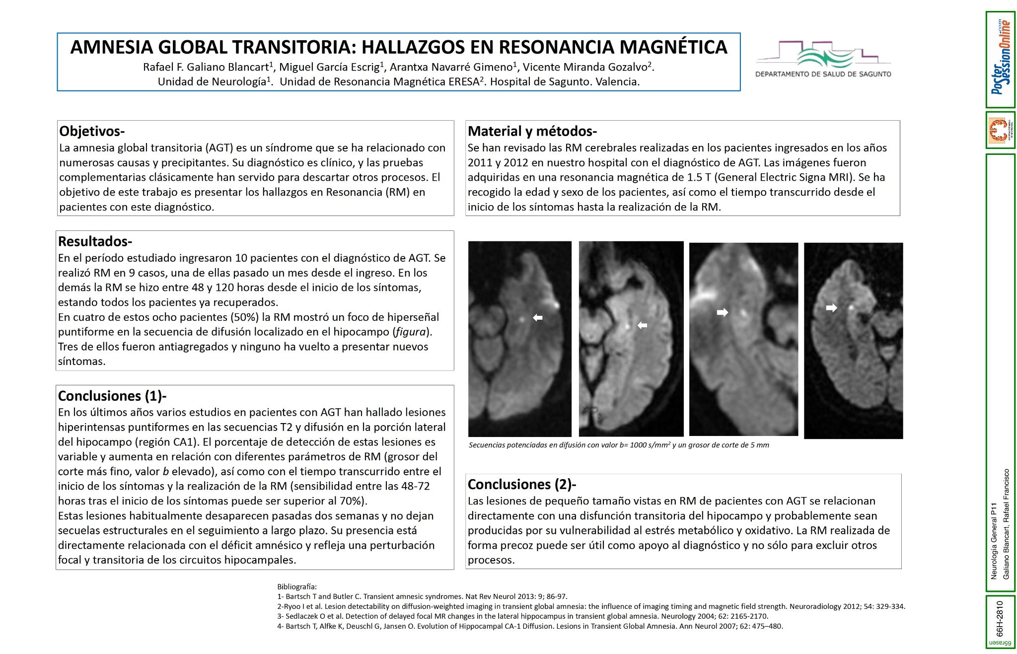 Amnesia global transitoria: hallazgos en resonancia magnética