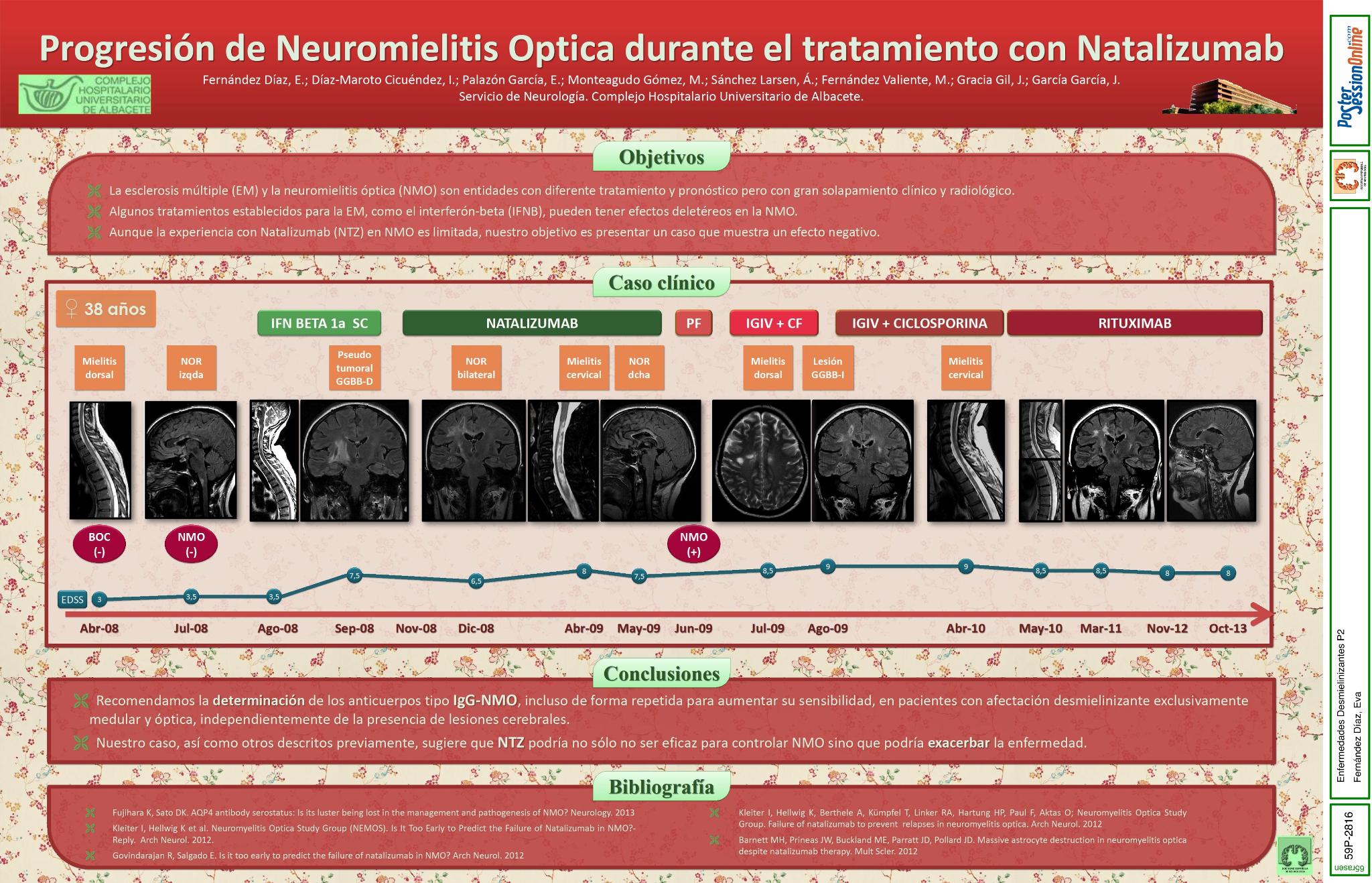 Progresión de la Neuromielitis Optica durante el tratamiento con Natalizumab