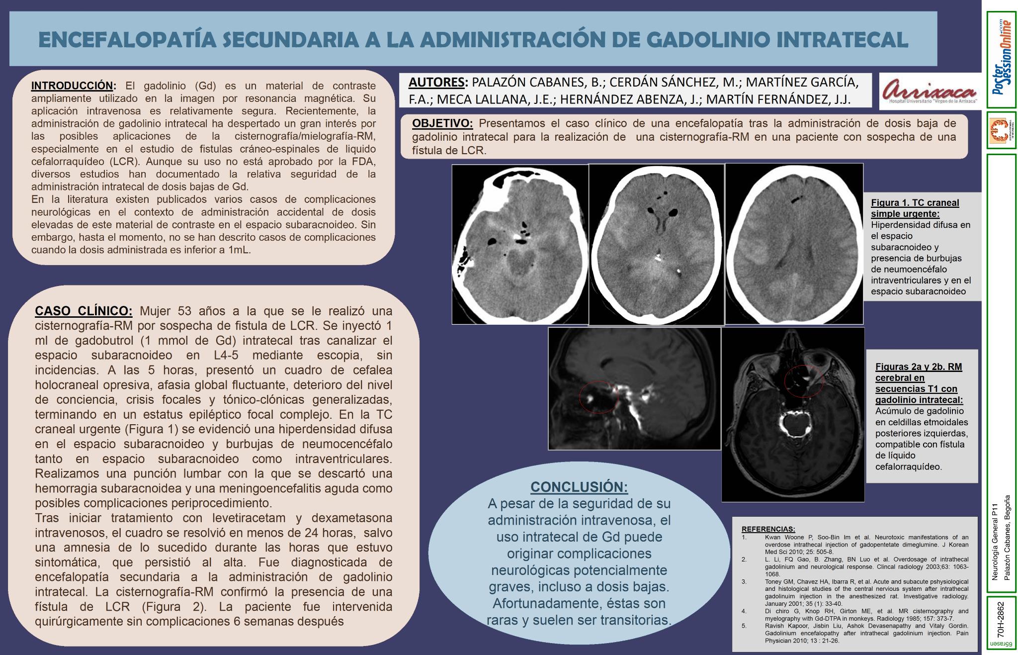 Encefalopatia secundaria a la administración de dosis baja de gadolinio intratecal. Caso clínico