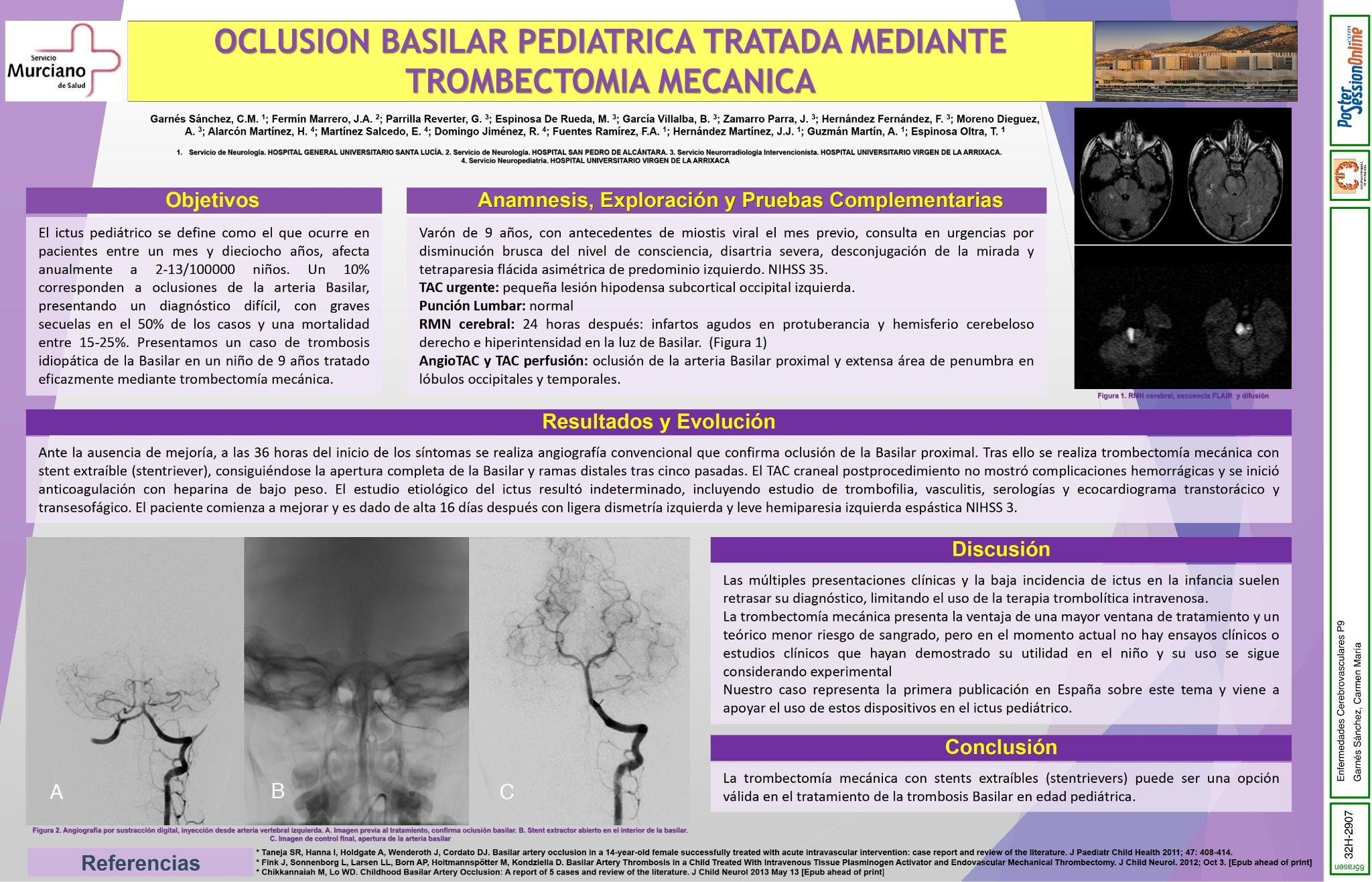 Oclusión basilar pediátrica tratada mediante trombectomia mecánica