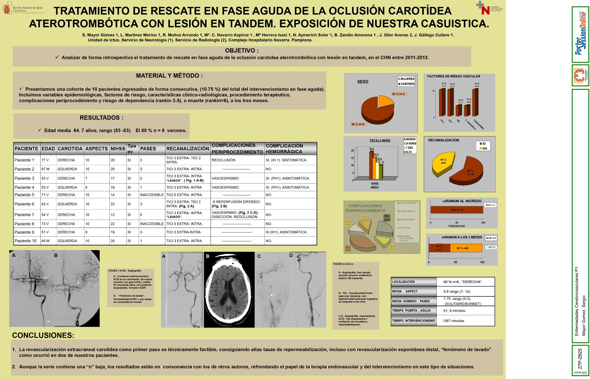 Tratamiento de rescate en fase aguda de la oclusión carotídea aterotrombótica con lesión en tandem. exposición de nuestra casuistica