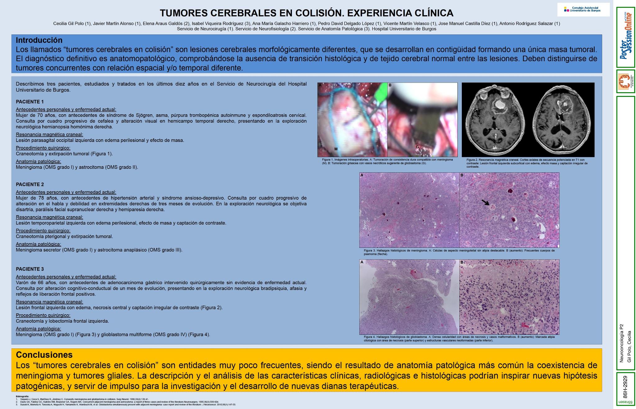 Tumores cerebrales en colisión. Experiencia clínica y revisión de la literatura
