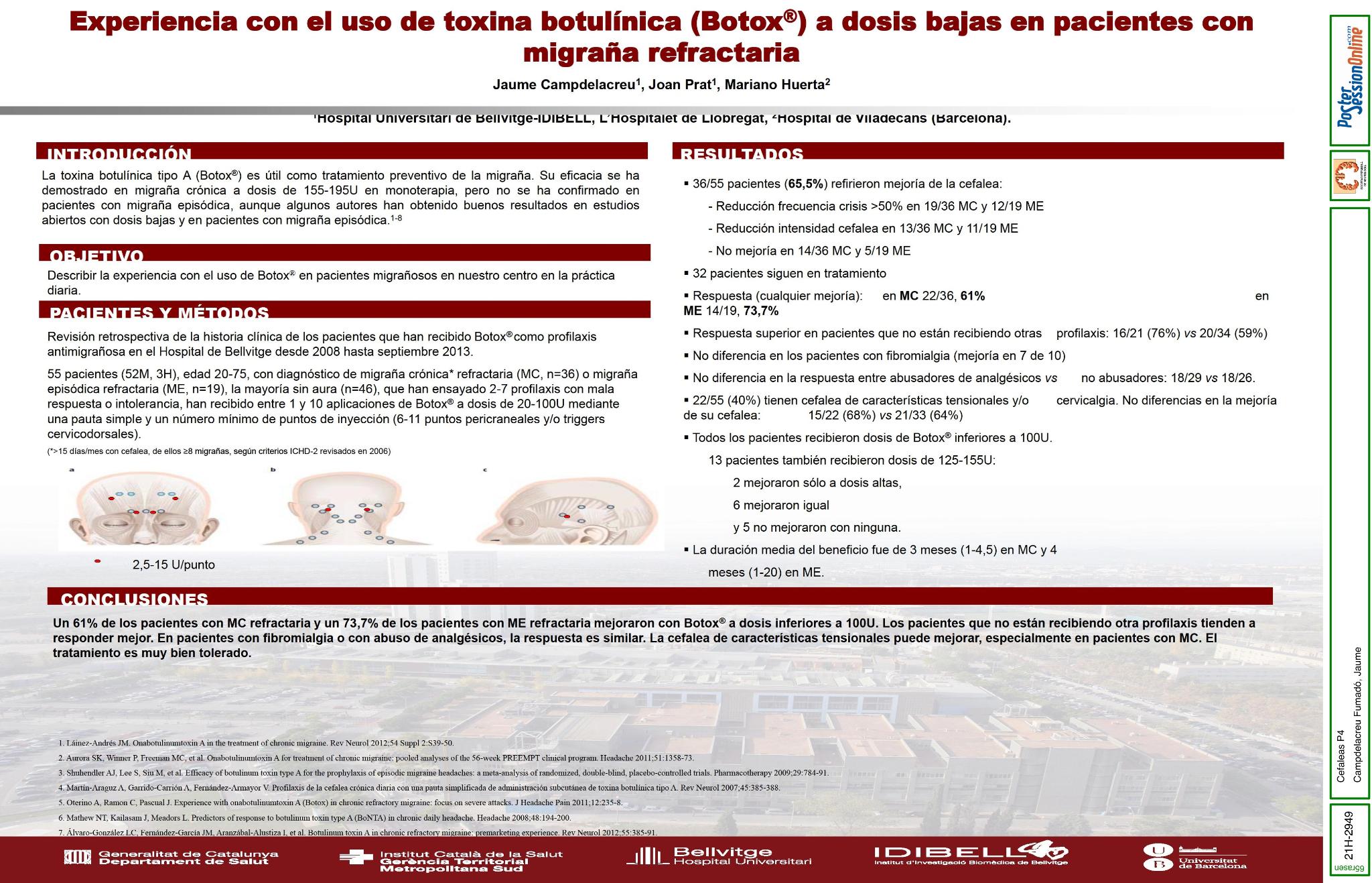 Experiencia con el uso de toxina botulínica (Botox®) a dosis bajas en pacientes con migraña refractaria.