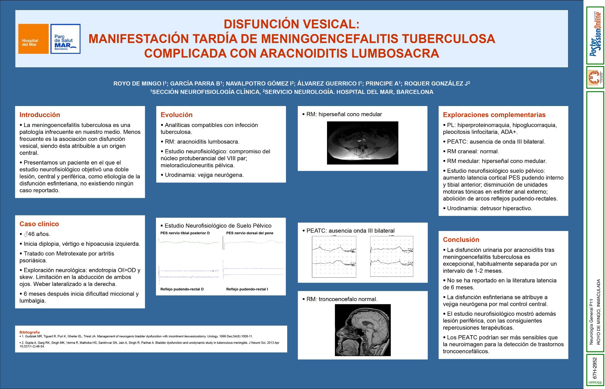 Disfunción vesical. Manifestación tardía de meningoencefalitis tuberculosa complicada con aracnoiditis lumbosacra