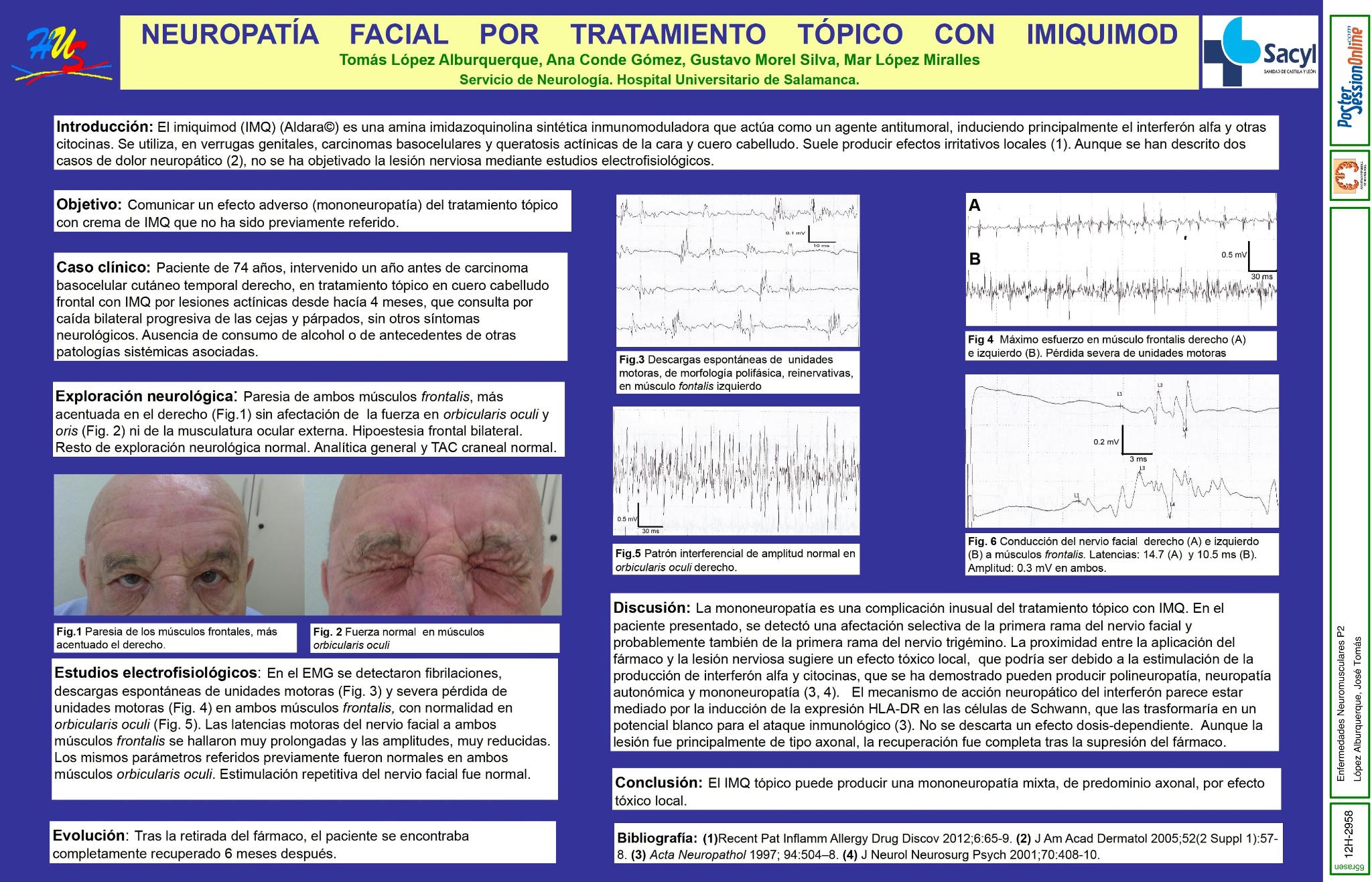 Neuropatía facial por tratamiento tópico con imiquimod