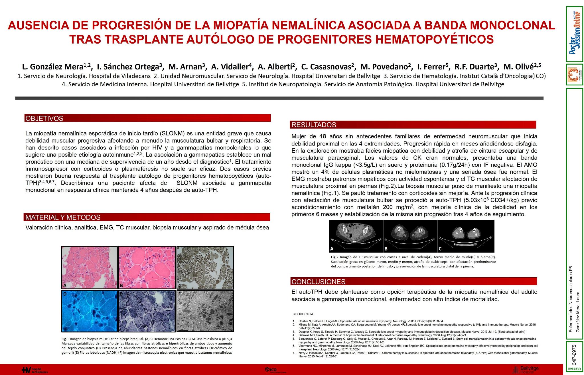 Ausencia de progresión de la Miopatía nemalínica asociada a banda monoclonal  tras trasplante autólogo de progenitores hematopoyéticos