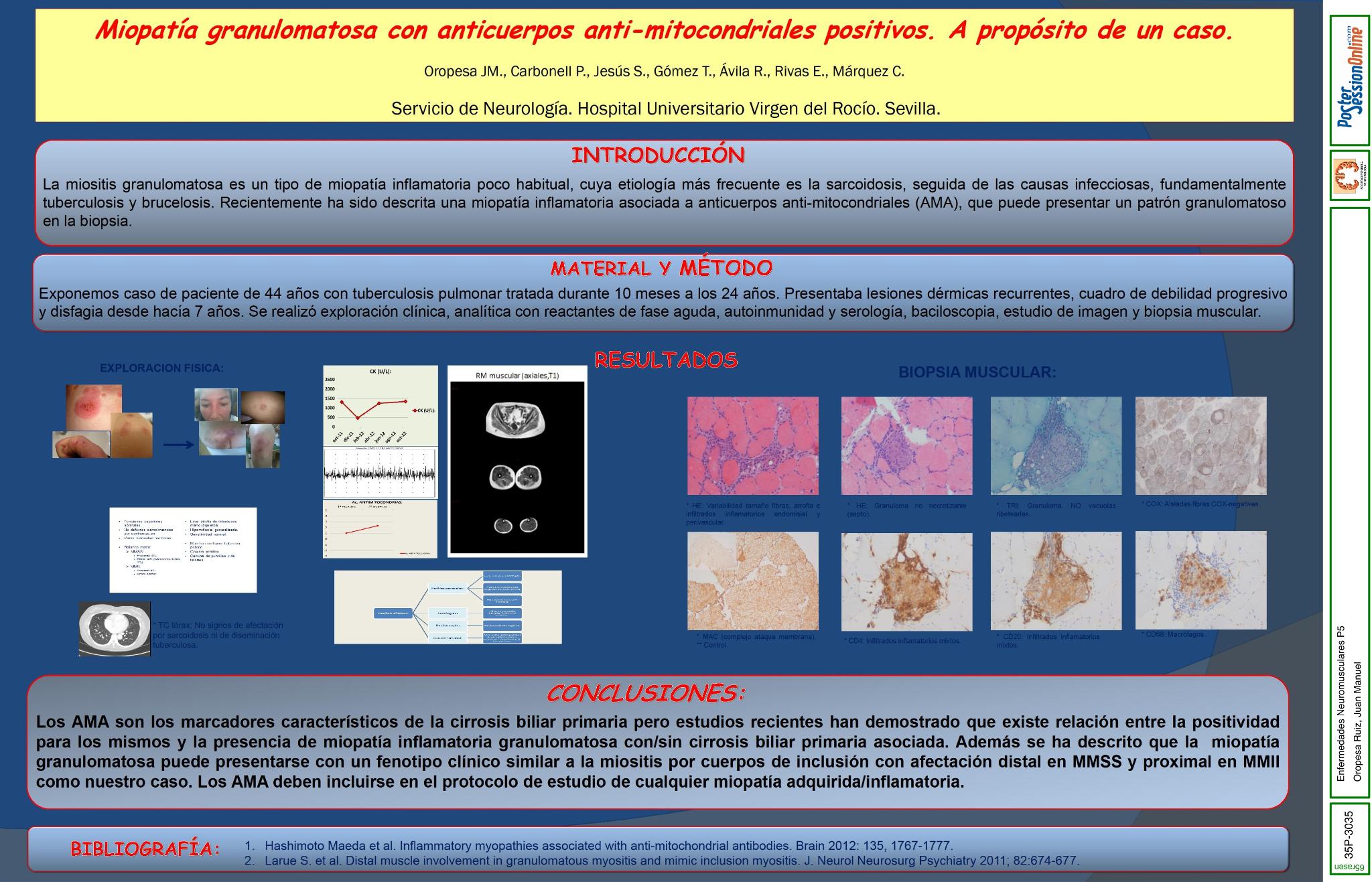 Miopatía granulomatosa con anticuerpos anti-mitocondriales positivos. A propósito de un caso.
