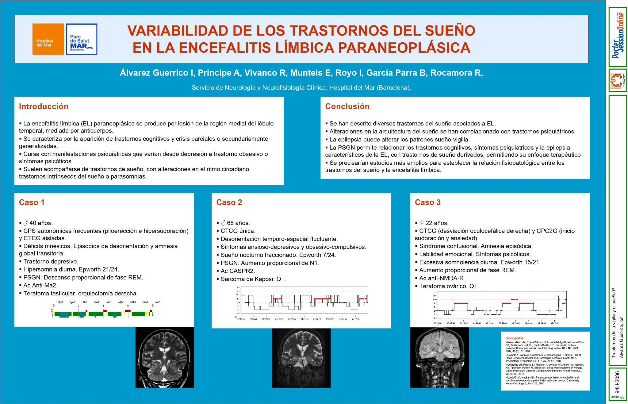 Variabilidad de los trastornos del sueño en la encefalitis límbica paraneoplásica