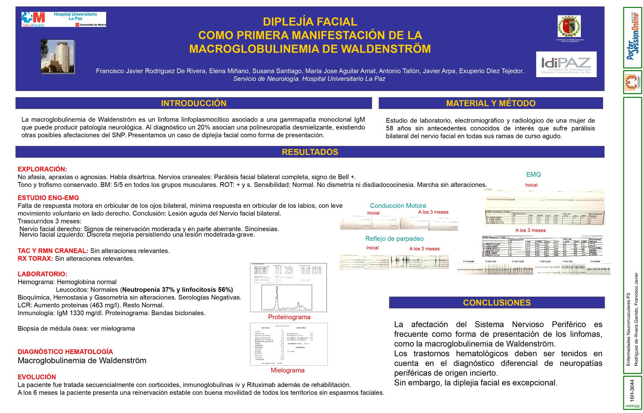 Diplejía facial como primera manifestación de la macroglobulinemia de Waldenström
