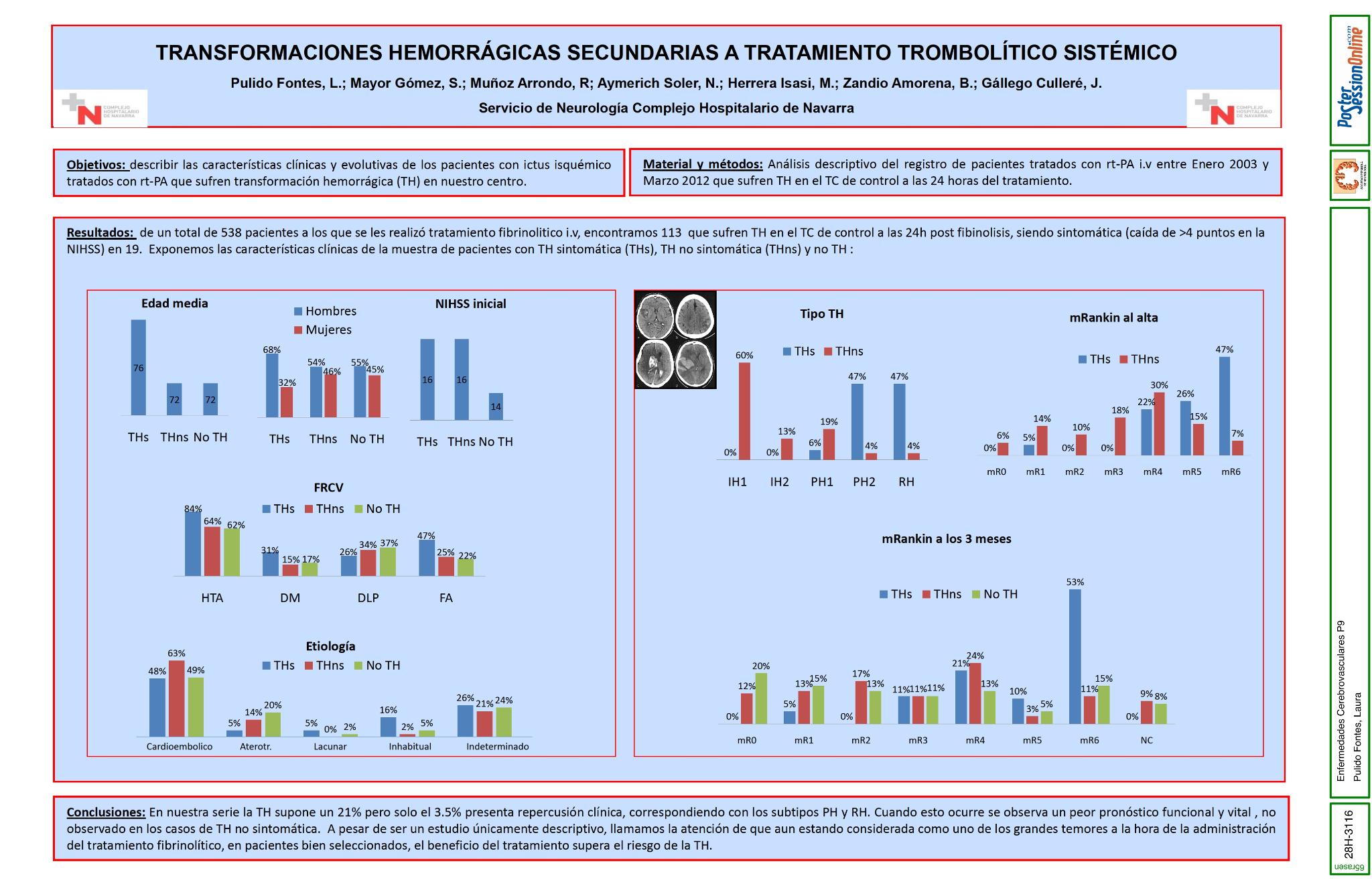 Descripción transformaciones hemorragicas (TH) tras tratamiento con rt-PA endovenoso en el Complejo Hospitalario de Navarra.