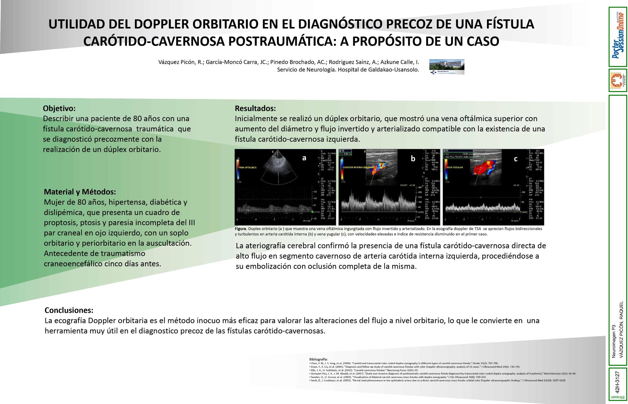 Utilidad del Doppler orbitario en el diagnostico precoz de una fístula carotido-cavernosa postraumática: a proposito de un caso