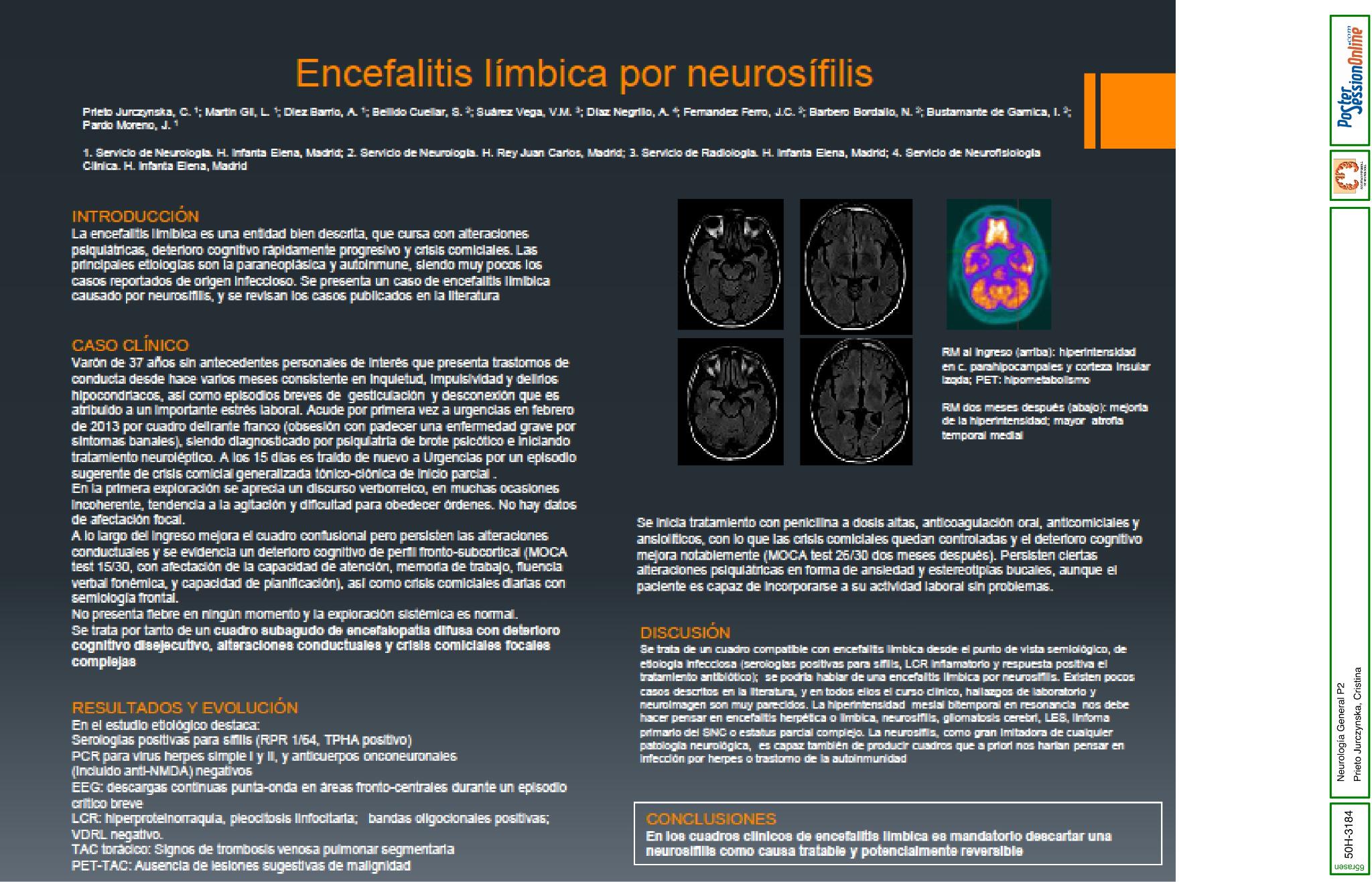 Encefalitis límibica por neurosífilis