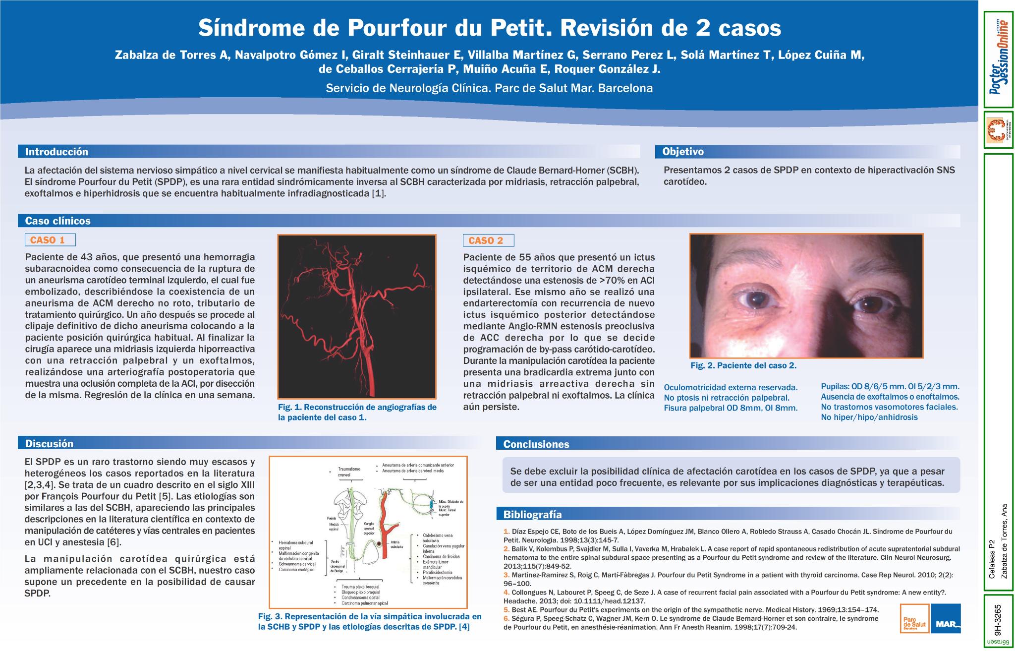 Síndrome de Pourfour du Petit. Revisión de 2 casos