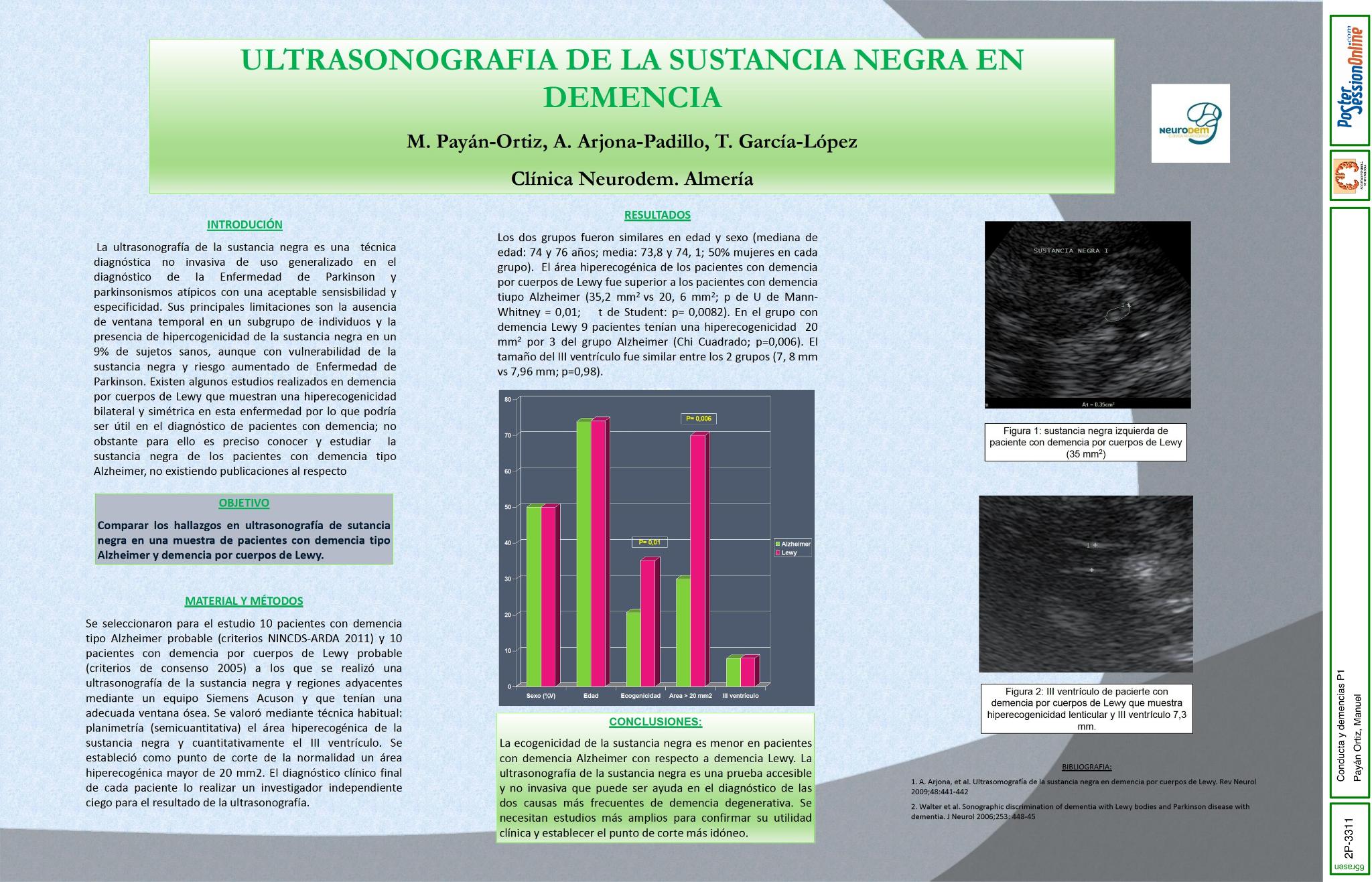 Ultrasonografía de la sustancia negra en demencia