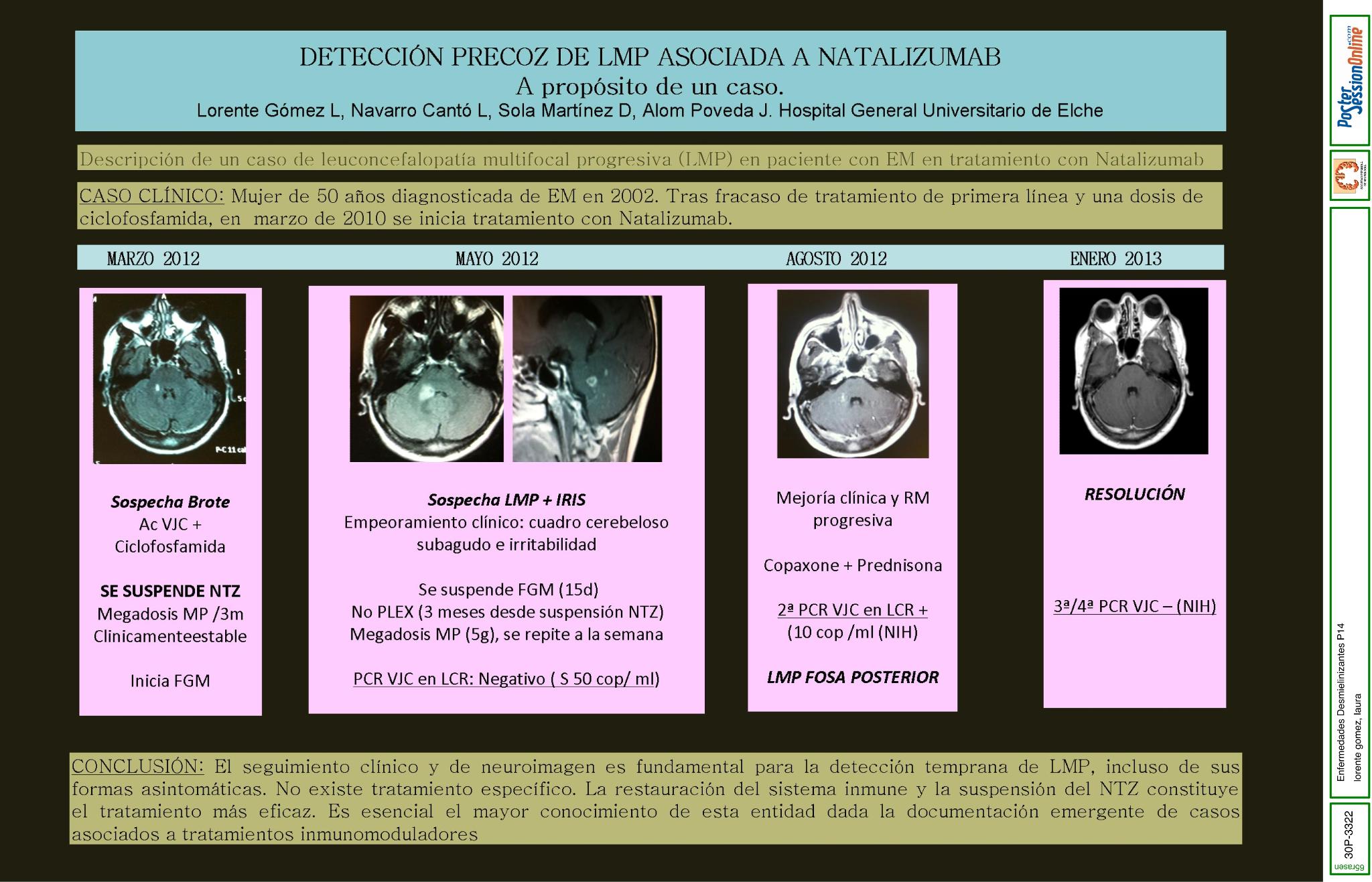 Detección precoz de LMP asociada a Natalizumab. A propósito de un caso