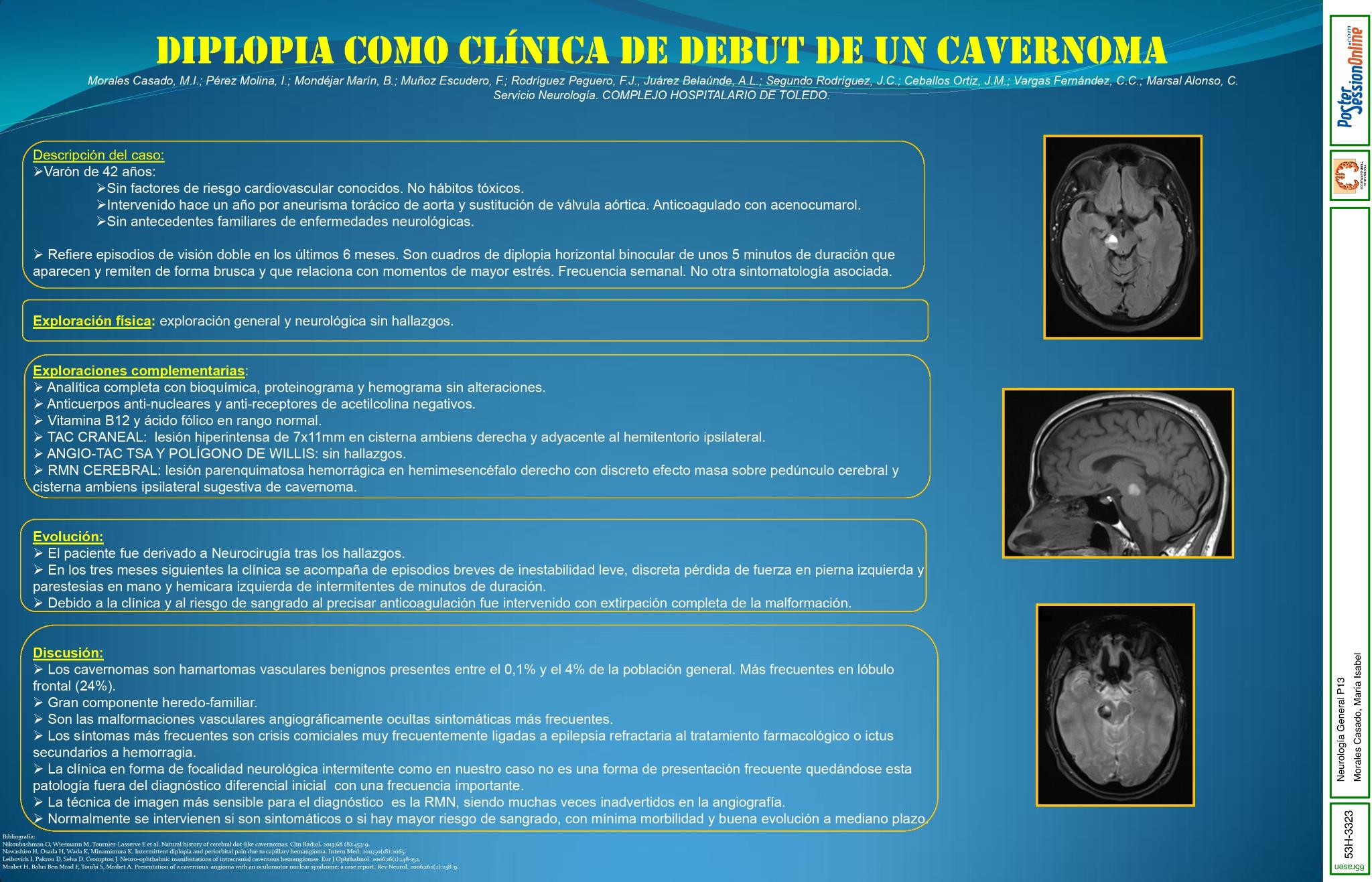 Diplopia como clínica de debut de cavernoma